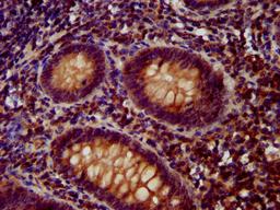 IHC image of CSB-PA753588LA01HU diluted at 1:400 and staining in paraffin-embedded human appendix tissue performed on a Leica BondTM system. After dewaxing and hydration, antigen retrieval was mediated by high pressure in a citrate buffer (pH 6.0). Section was blocked with 10% normal goat serum 30min at RT. Then primary antibody (1% BSA) was incubated at 4&deg;C overnight. The primary is detected by a biotinylated secondary antibody and visualized using an HRP conjugated SP system.
