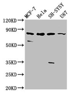 Western Blot. Positive WB detected in: MCF-7 whole cell lysate, Hela whole cell lysate, SH-SY5Y whole cell lysate, U87 whole cell lysate. All lanes: IL1RAPL1 antibody at 5.4µg/ml. Secondary. Goat polyclonal to rabbit IgG at 1/50000 dilution. Predicted band size: 80 kDa. Observed band size: 80 kDa