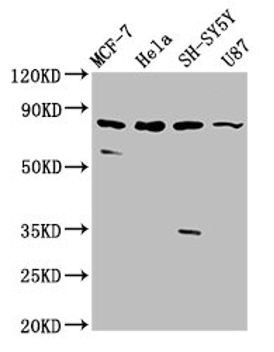 Western Blot. Positive WB detected in: MCF-7 whole cell lysate, Hela whole cell lysate, SH-SY5Y whole cell lysate, U87 whole cell lysate. All lanes: IL1RAPL1 antibody at 5.4µg/ml. Secondary. Goat polyclonal to rabbit IgG at 1/50000 dilution. Predicted band size: 80 kDa. Observed band size: 80 kDa