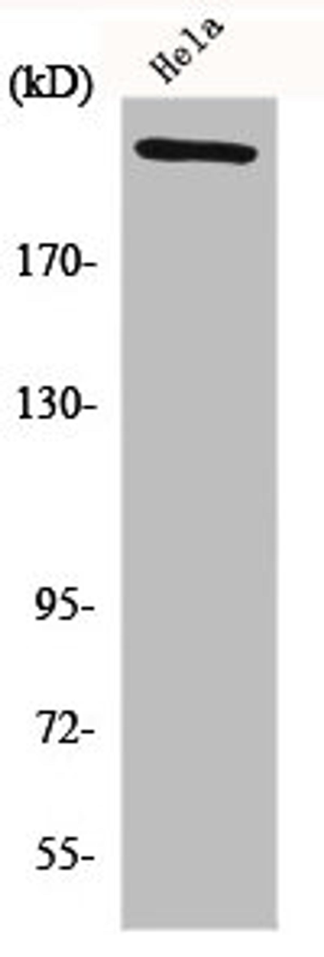 Western Blot analysis of HeLa cells using FN1 Polyclonal Antibody