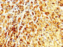 IHC image of CSB-PA647192LA01HU diluted at 1:250 and staining in paraffin-embedded human adrenal gland tissue performed on a Leica BondTM system. After dewaxing and hydration, antigen retrieval was mediated by high pressure in a citrate buffer (pH 6.0). Section was blocked with 10% normal goat serum 30min at RT. Then primary antibody (1% BSA) was incubated at 4&deg;C overnight. The primary is detected by a biotinylated secondary antibody and visualized using an HRP conjugated SP system.