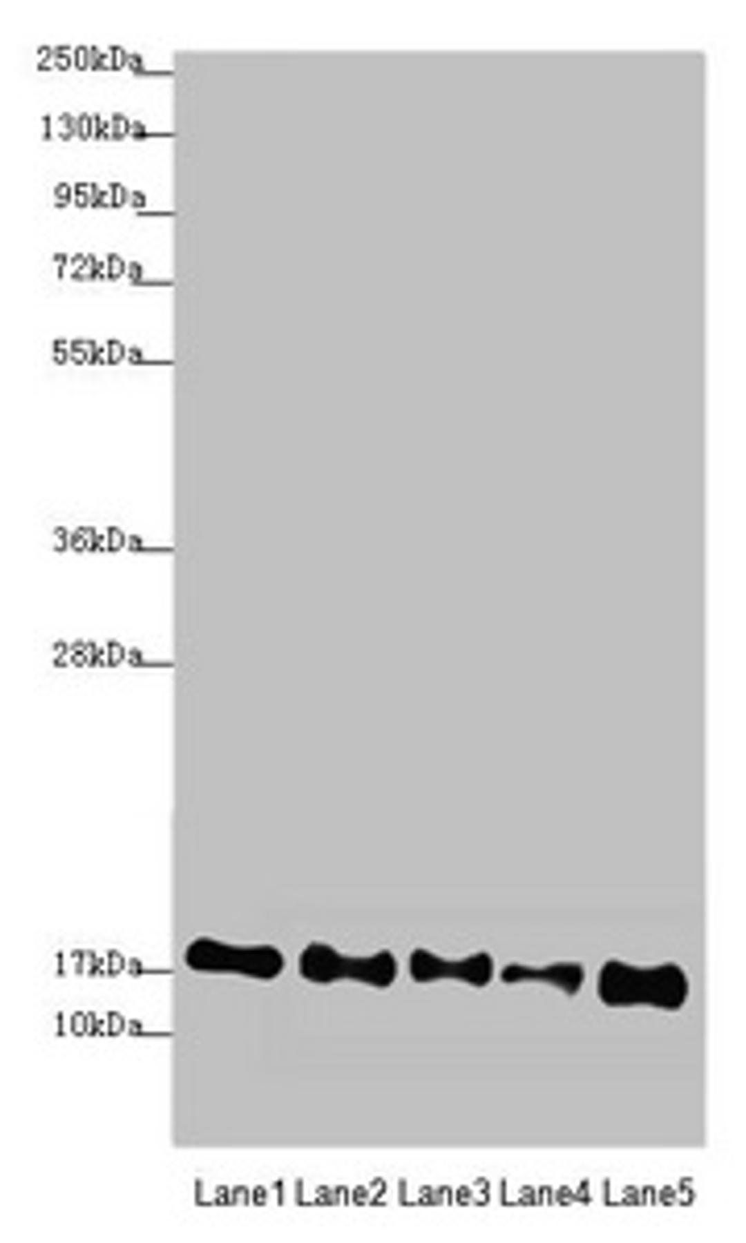 Western blot. All lanes: ATP5F1D antibody at 2.44µg/ml. Lane 1: Mouse heart tissue. Lane 2: Raji whole cell lysate. Lane 3: NIH/3T3 whole cell lysate. Lane 4: A549 whole cell lysate. Lane 5: HepG2 whole cell lysate. Secondary. Goat polyclonal to rabbit IgG at 1/10000 dilution. Predicted band size: 18 kDa. Observed band size: 18 kDa