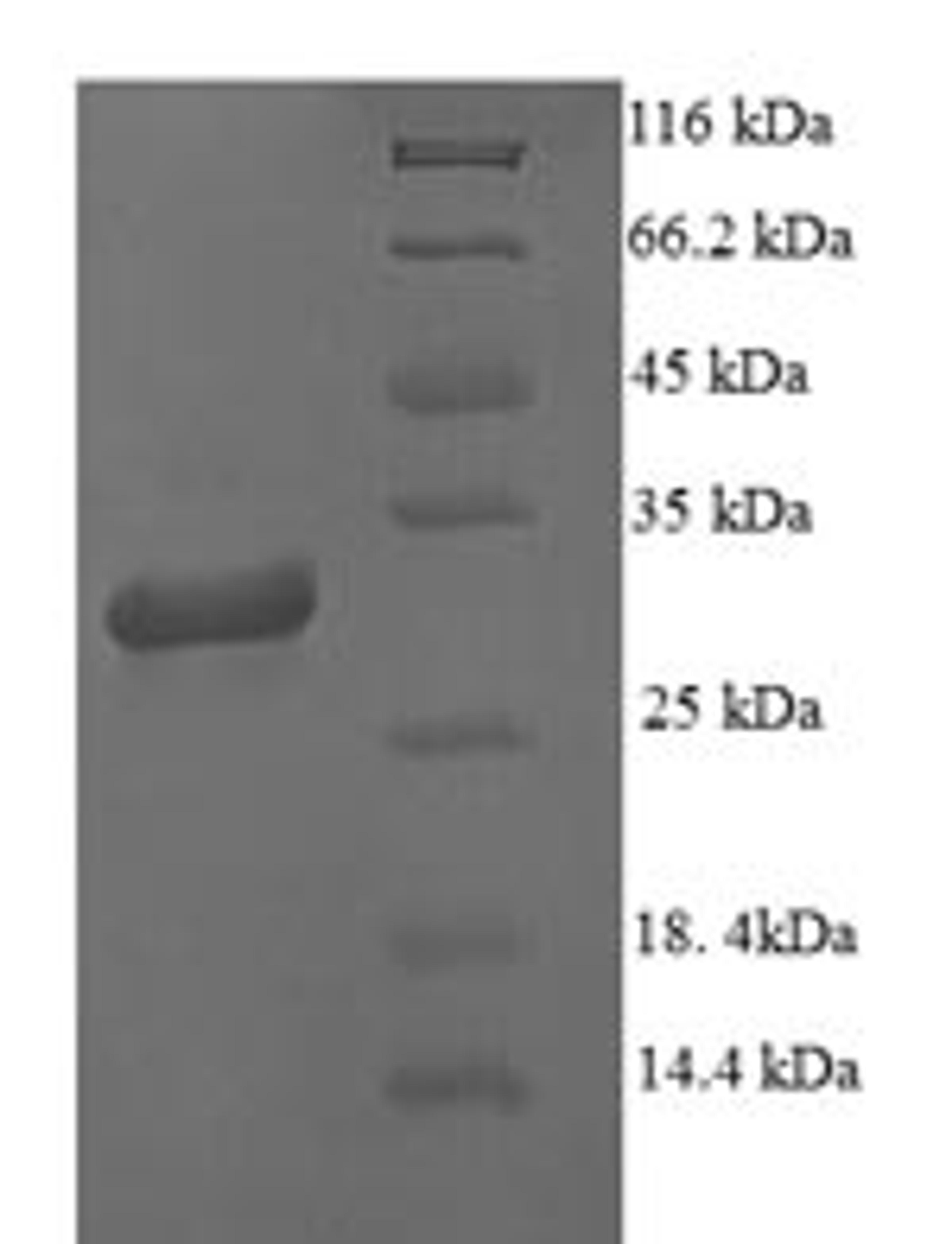 (Tris-Glycine gel) Discontinuous SDS-PAGE (reduced) with 5% enrichment gel and 15% separation gel.