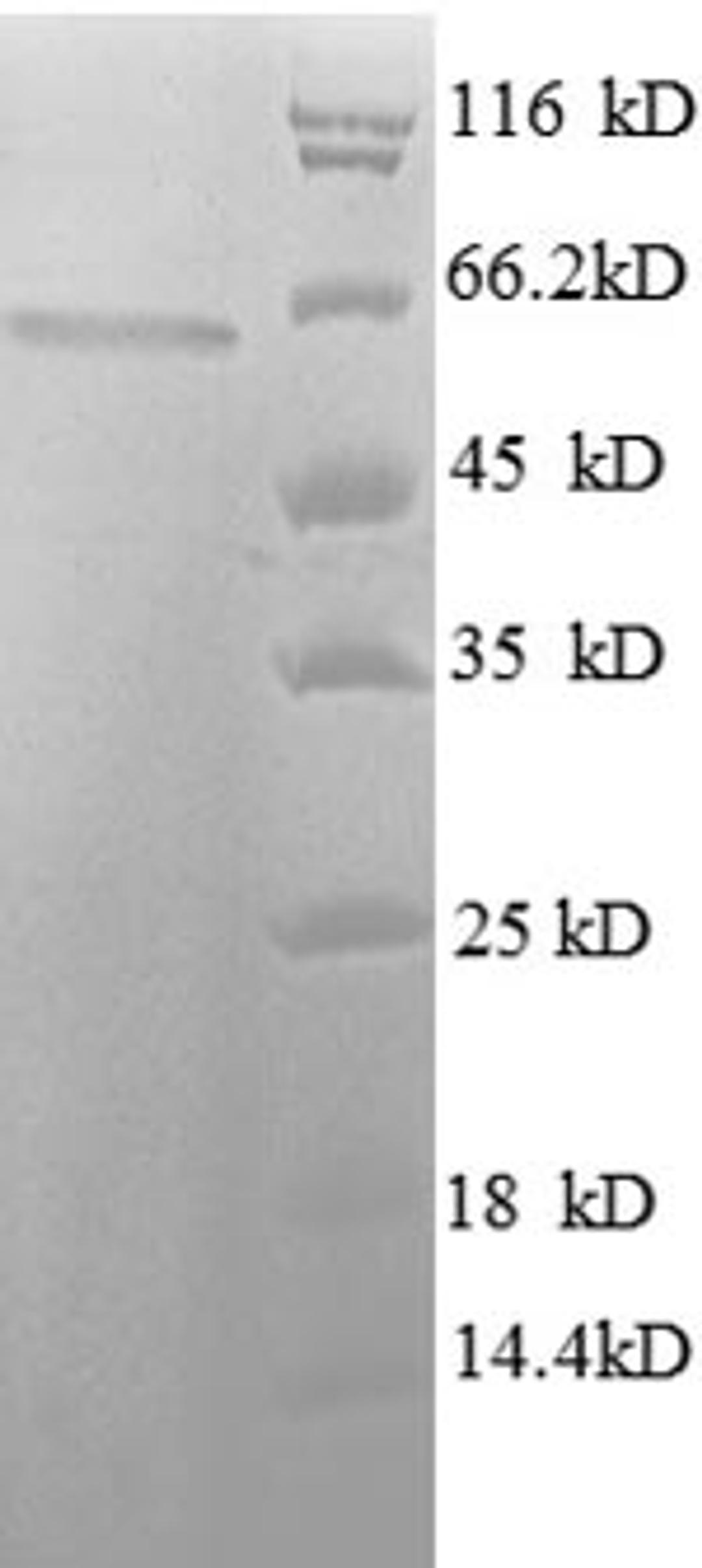 (Tris-Glycine gel) Discontinuous SDS-PAGE (reduced) with 5% enrichment gel and 15% separation gel.
