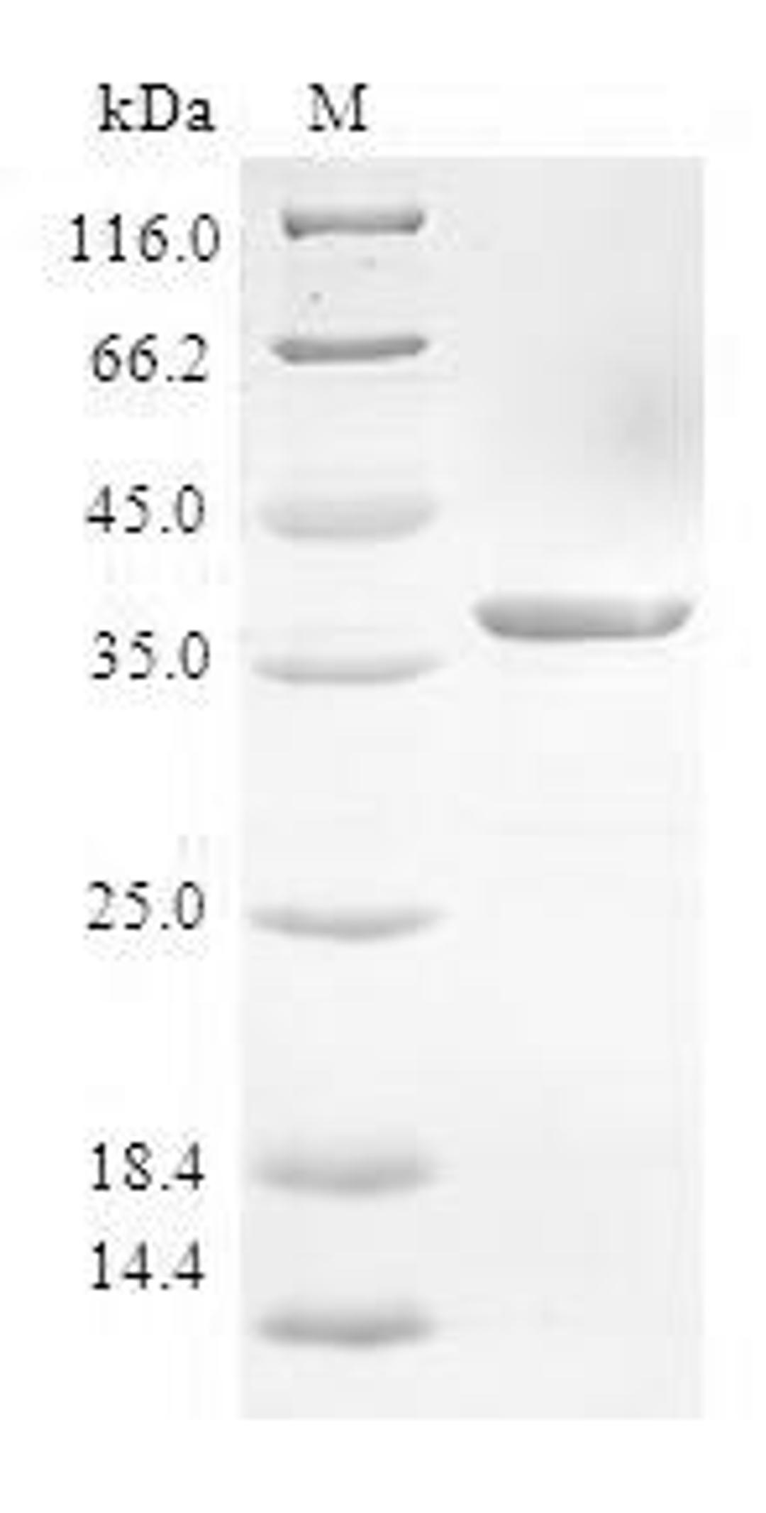 (Tris-Glycine gel) Discontinuous SDS-PAGE (reduced) with 5% enrichment gel and 15% separation gel.