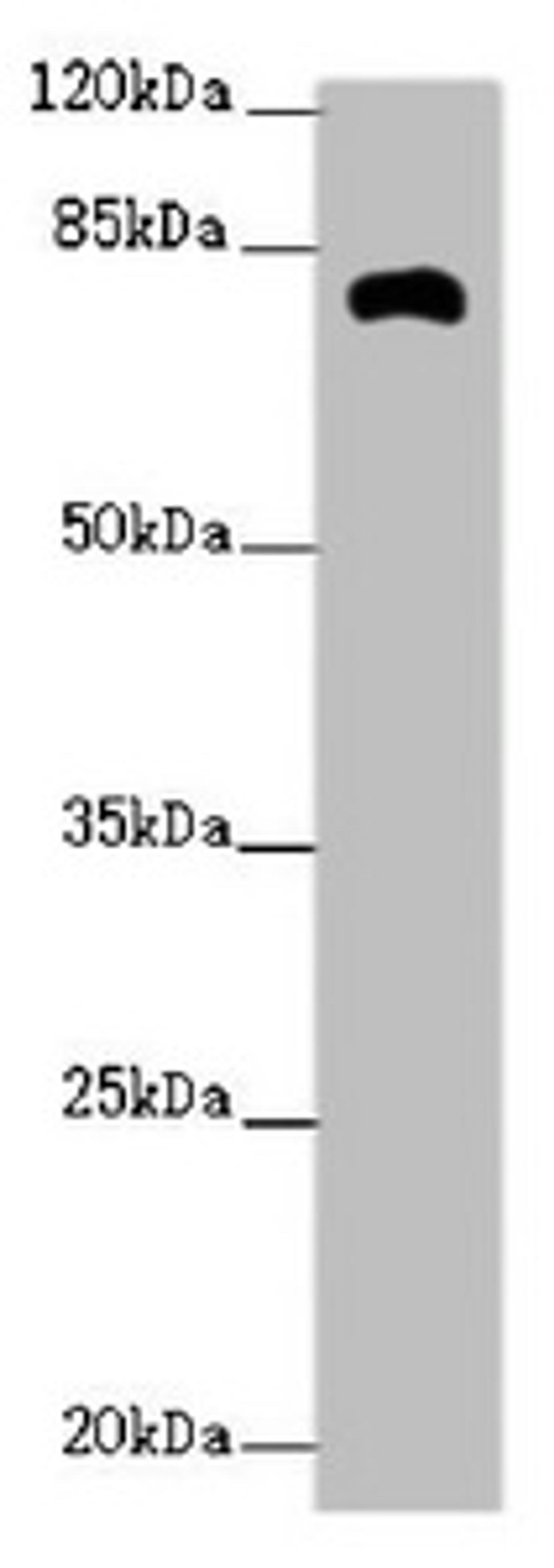 Western blot. All lanes: ZFYVE1 antibody at 2.62ug/ml + Mouse kidney tissue. Secondary. Goat polyclonal to rabbit IgG at 1/10000 dilution. Predicted band size: 88, 41, 86 kDa. Observed band size: 81 kDa. 