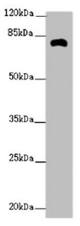 Western blot. All lanes: ZFYVE1 antibody at 2.62ug/ml + Mouse kidney tissue. Secondary. Goat polyclonal to rabbit IgG at 1/10000 dilution. Predicted band size: 88, 41, 86 kDa. Observed band size: 81 kDa. 