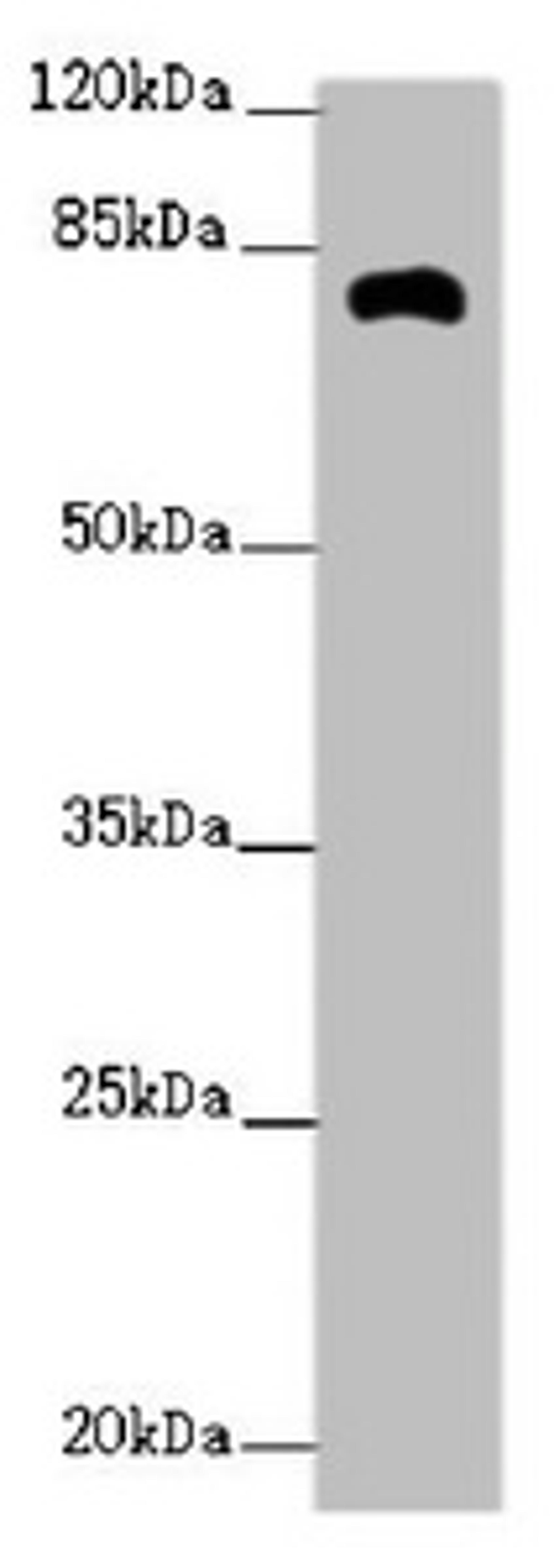 Western blot. All lanes: ZFYVE1 antibody at 2.62ug/ml + Mouse kidney tissue. Secondary. Goat polyclonal to rabbit IgG at 1/10000 dilution. Predicted band size: 88, 41, 86 kDa. Observed band size: 81 kDa. 