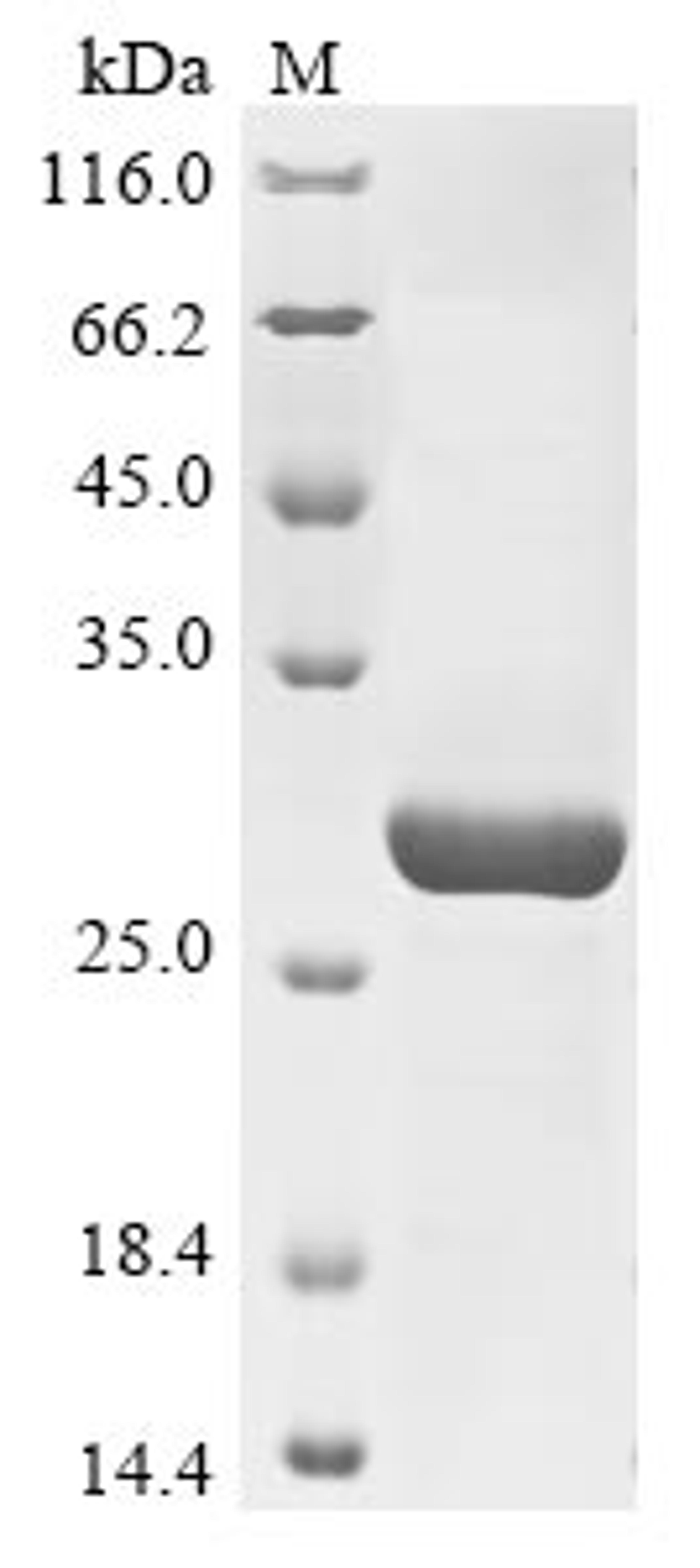 (Tris-Glycine gel) Discontinuous SDS-PAGE (reduced) with 5% enrichment gel and 15% separation gel.