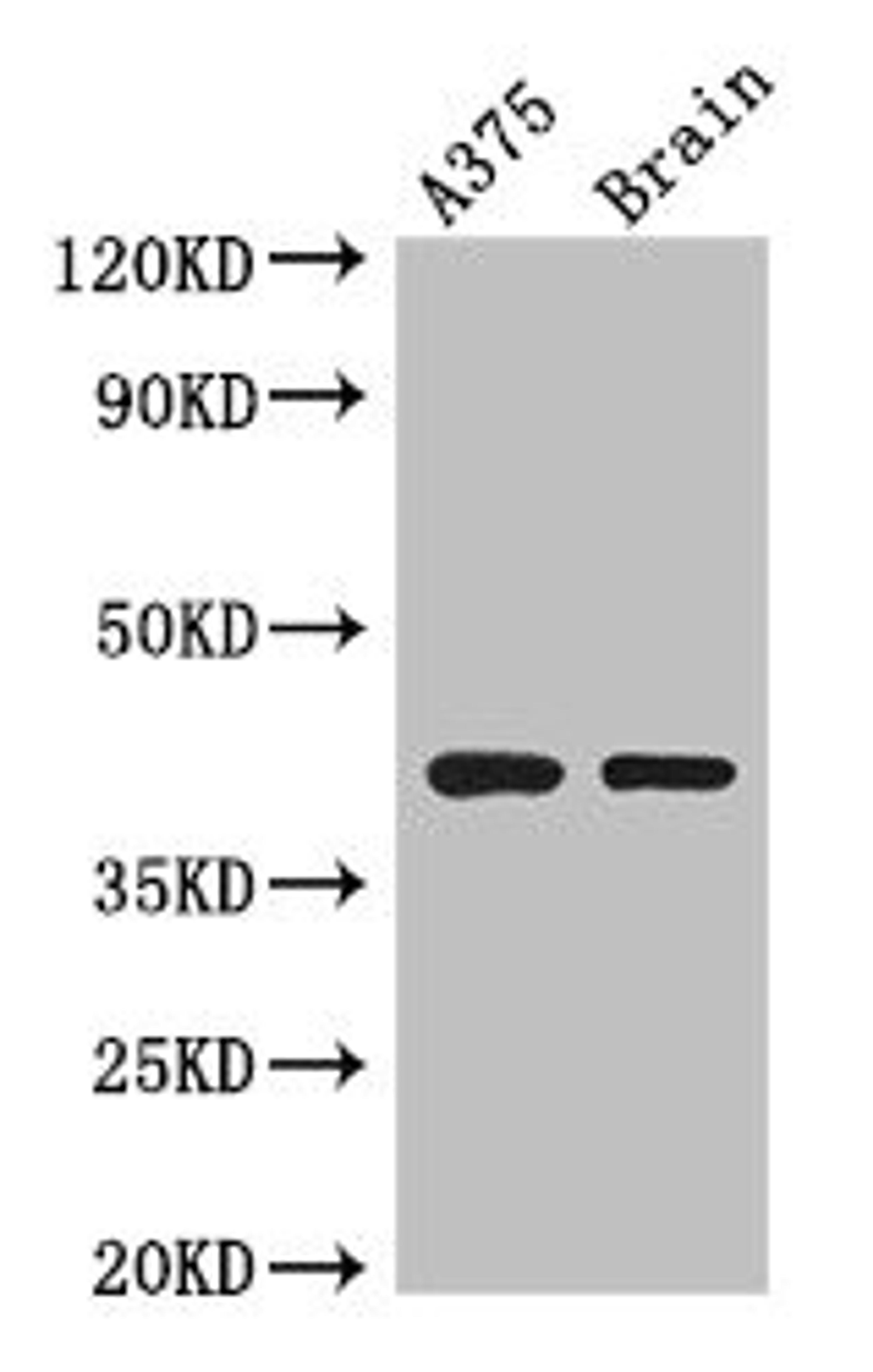 Western Blot. Positive WB detected in: A375 whole cell lysate, Mouse brain tissue. All lanes: SEPT12 antibody at 3.5µg/ml. Secondary. Goat polyclonal to rabbit IgG at 1/50000 dilution. Predicted band size: 41, 36 kDa. Observed band size: 41 kDa