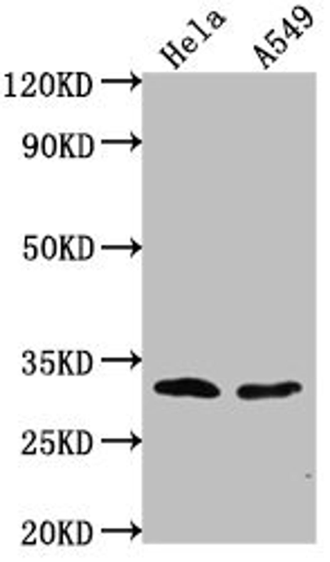 Western Blot. Positive WB detected in: Hela whole cell lysate, A549 whole cell lysate. All lanes: VAX2 antibody at 1:2000. Secondary. Goat polyclonal to rabbit IgG at 1/50000 dilution. Predicted band size: 31 kDa. Observed band size: 31 kDa. 
