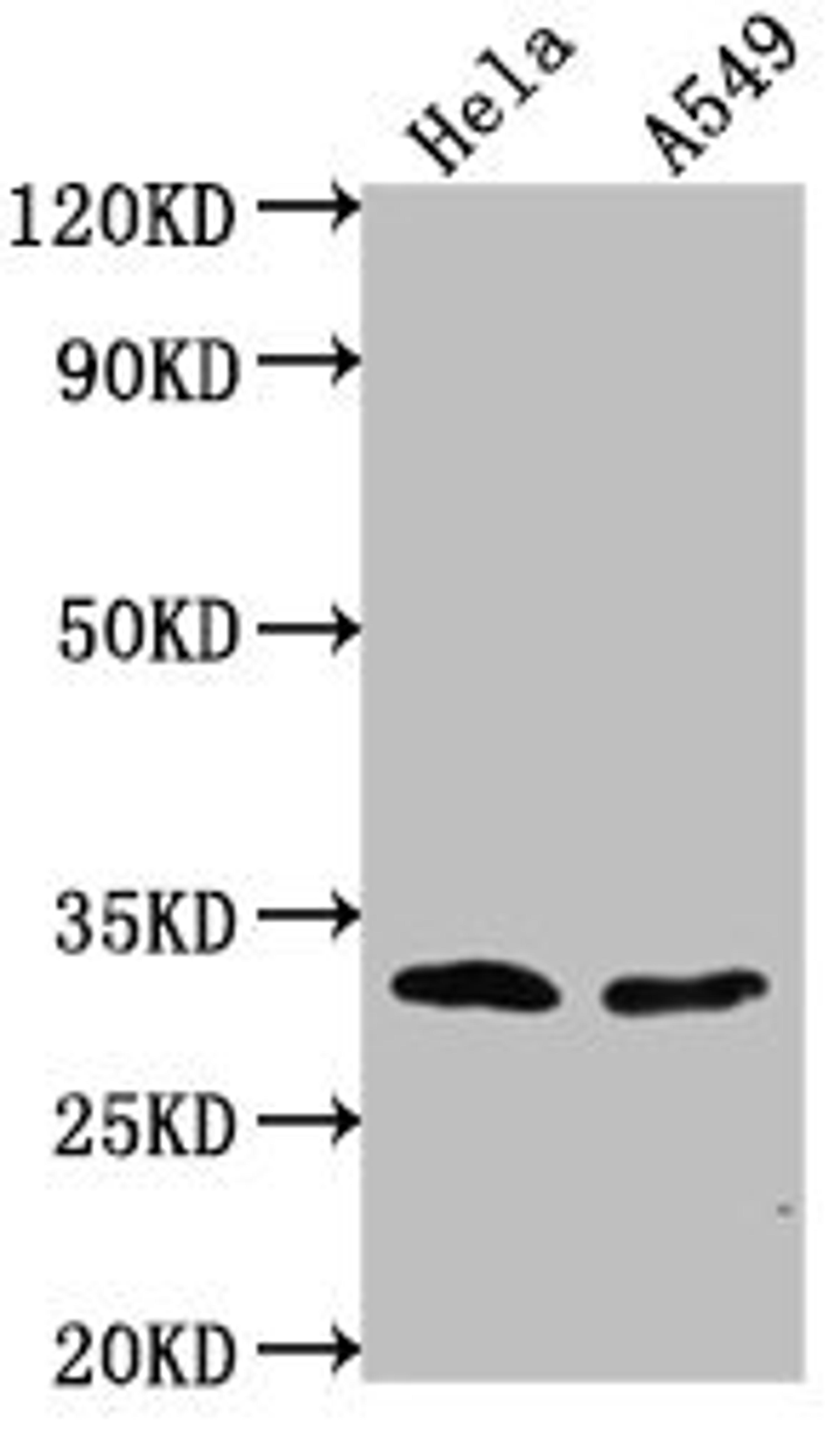 Western Blot. Positive WB detected in: Hela whole cell lysate, A549 whole cell lysate. All lanes: VAX2 antibody at 1:2000. Secondary. Goat polyclonal to rabbit IgG at 1/50000 dilution. Predicted band size: 31 kDa. Observed band size: 31 kDa. 