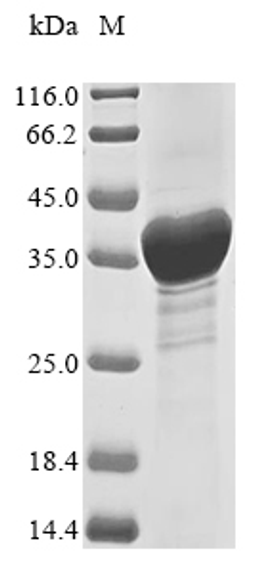 (Tris-Glycine gel) Discontinuous SDS-PAGE (reduced) with 5% enrichment gel and 15% separation gel.