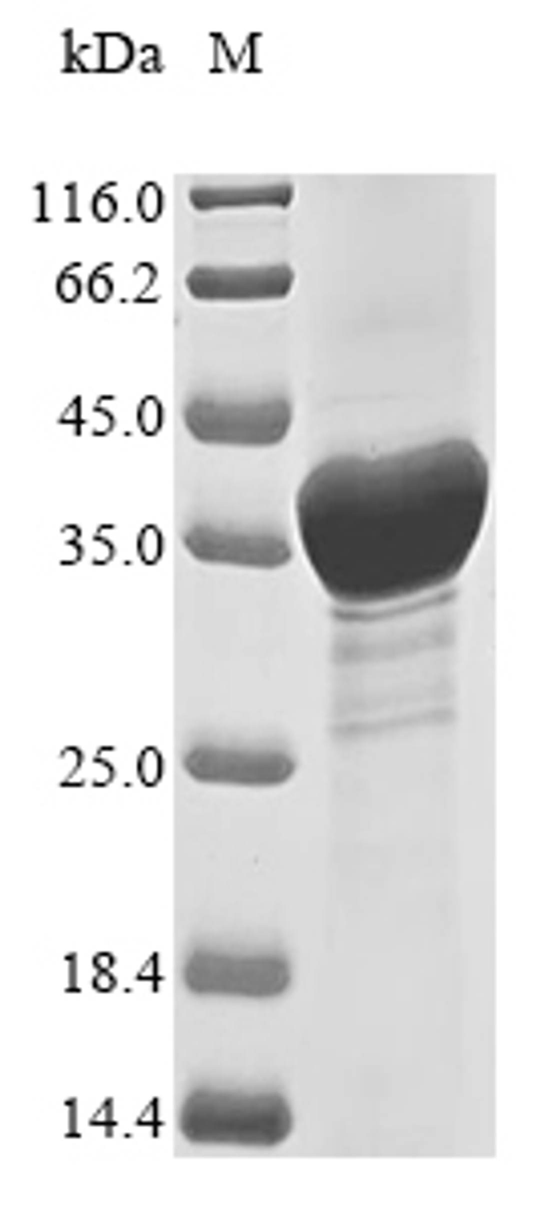 (Tris-Glycine gel) Discontinuous SDS-PAGE (reduced) with 5% enrichment gel and 15% separation gel.