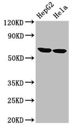 Western Blot. Positive WB detected in: HepG2 whole cell lysate, Hela whole cell lysate. All lanes: CKAP4 antibody at 2.7µg/ml. Secondary. Goat polyclonal to rabbit IgG at 1/50000 dilution. Predicted band size: 67 kDa. Observed band size: 67 kDa