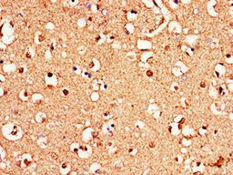 Immunohistochemistry of paraffin-embedded human brain tissue using CSB-PA009931LA01HU at dilution of 1:100