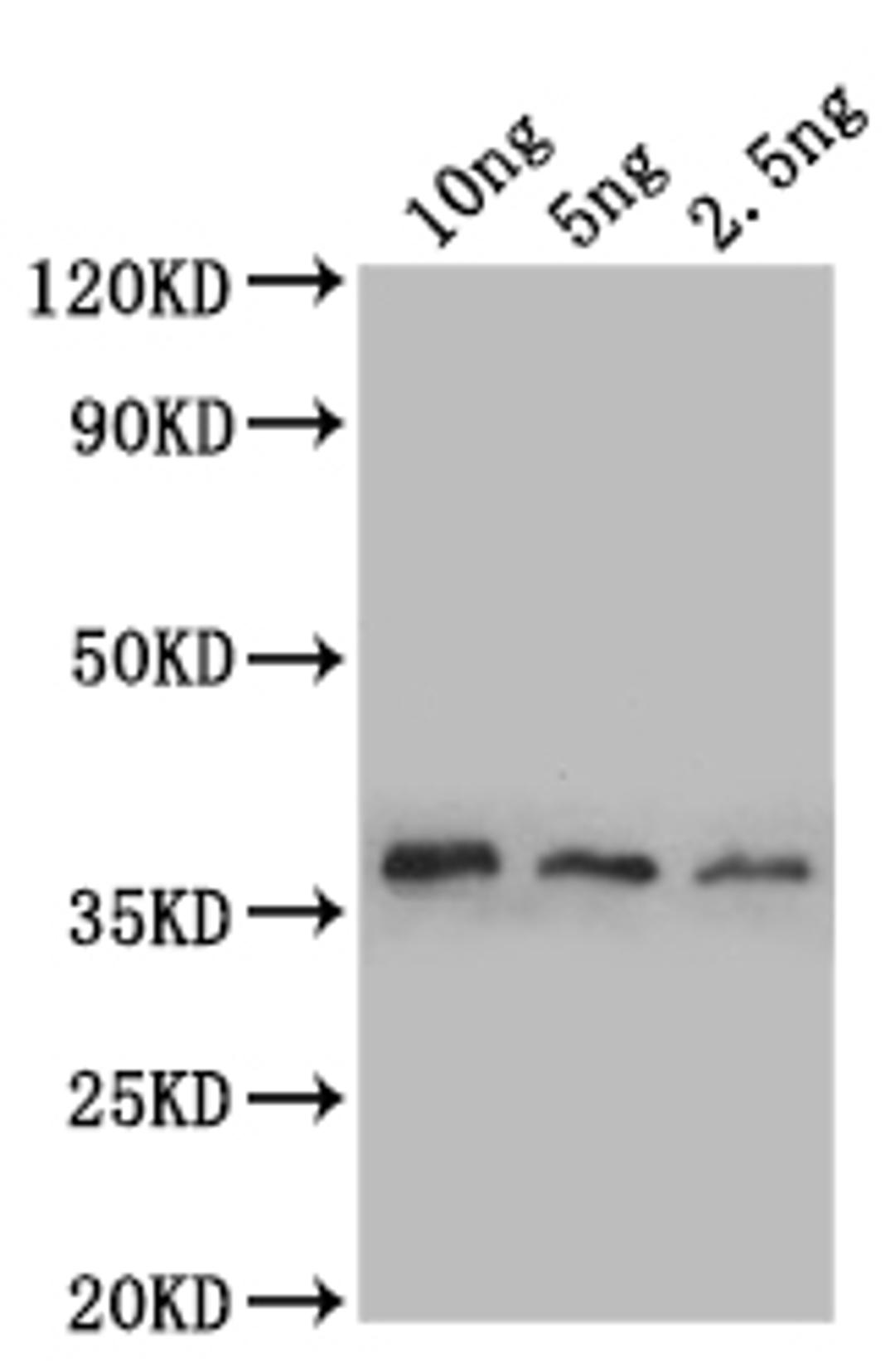 Western Blot. Positive WB detected in: recombinant protein. All lanes: sod1 Antibody at 1:1000. Secondary. Goat polyclonal to rabbit IgG at 1/50000 dilution. Predicted band size: 38 kDa. Observed band size: 38 kDa. 