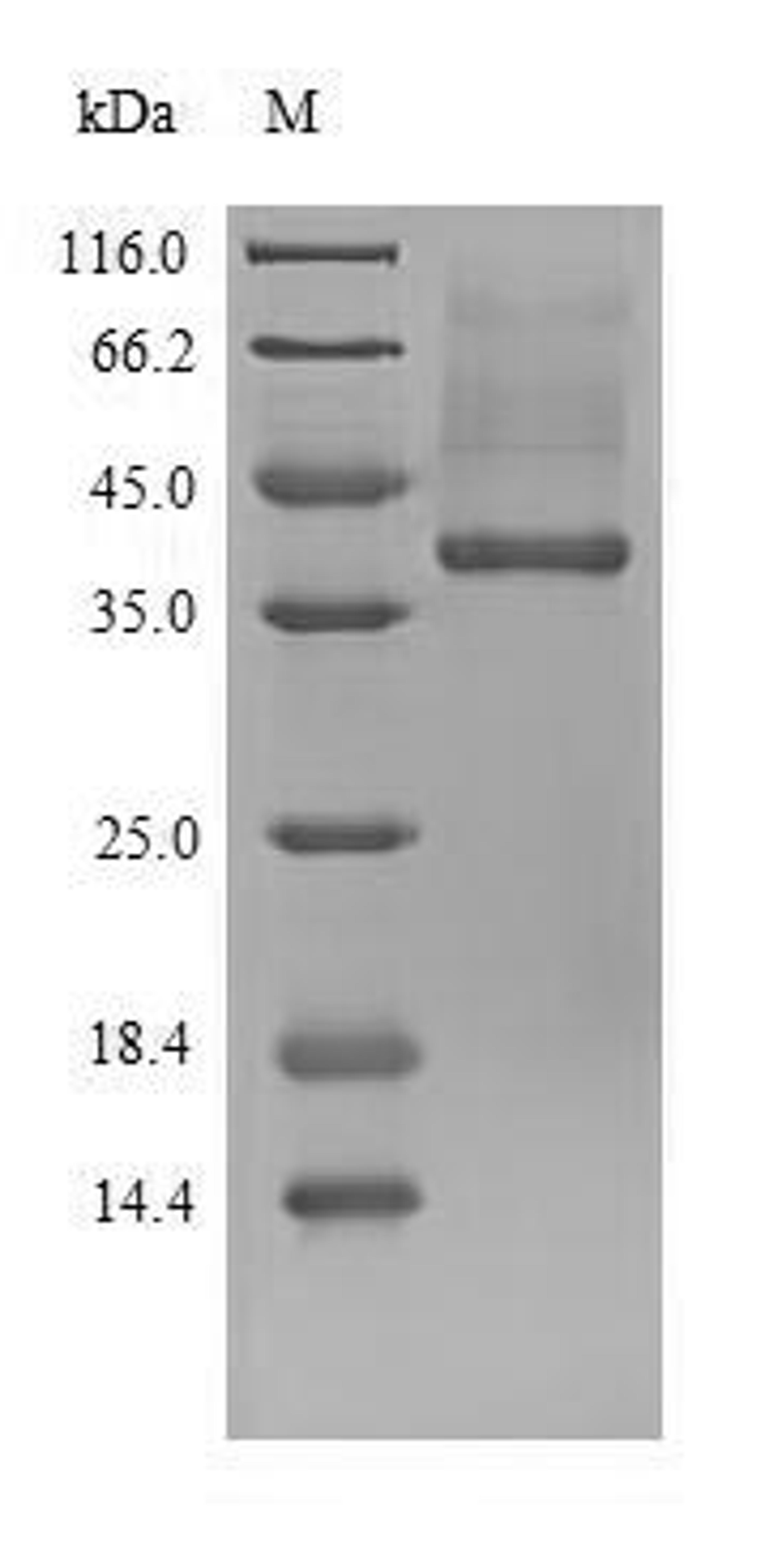 (Tris-Glycine gel) Discontinuous SDS-PAGE (reduced) with 5% enrichment gel and 15% separation gel.