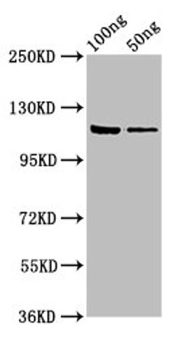 Western Blot. Positive WB detected in: Recombinant protein. All lanes: lacZ antibody at 7.5ug/ml. Secondary. Goat polyclonal to rabbit IgG at 1/50000 dilution. Predicted band size: 117 kDa. Observed band size: 117 kDa. 