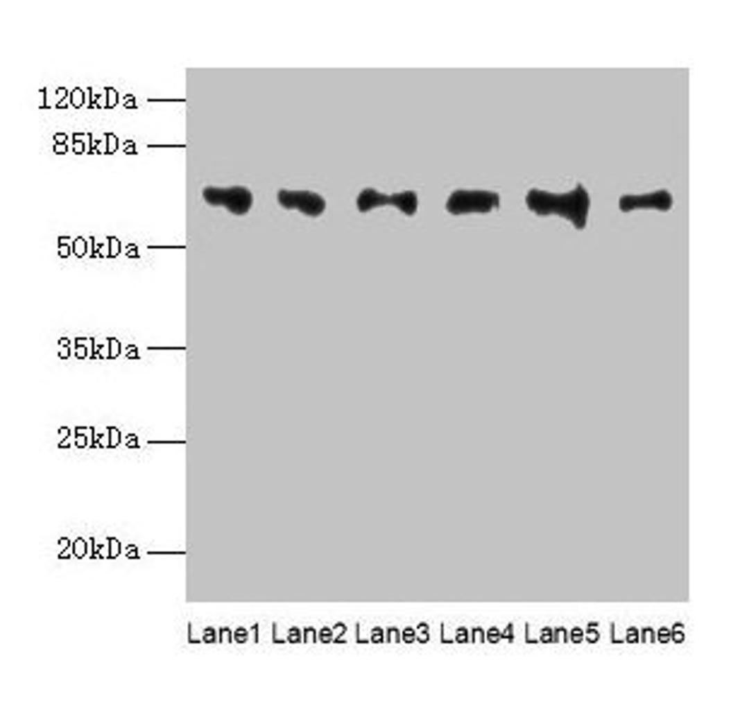 Western blot. All lanes: FBXO24 antibody at 1µg/ml. Lane 1: Mouse gonadal tissue. Lane 2: Mouse kidney tissue. Lane 3: A549 whole cell lysate. Lane 4: 293T whole cell lysate. Lane 5: Jurkat whole cell lysate. Lane 6: MCF-7 whole cell lysate. Secondary. Goat polyclonal to rabbit IgG at 1/10000 dilution. Predicted band size: 65, 37, 70, 64 kDa. Observed band size: 65 kDa