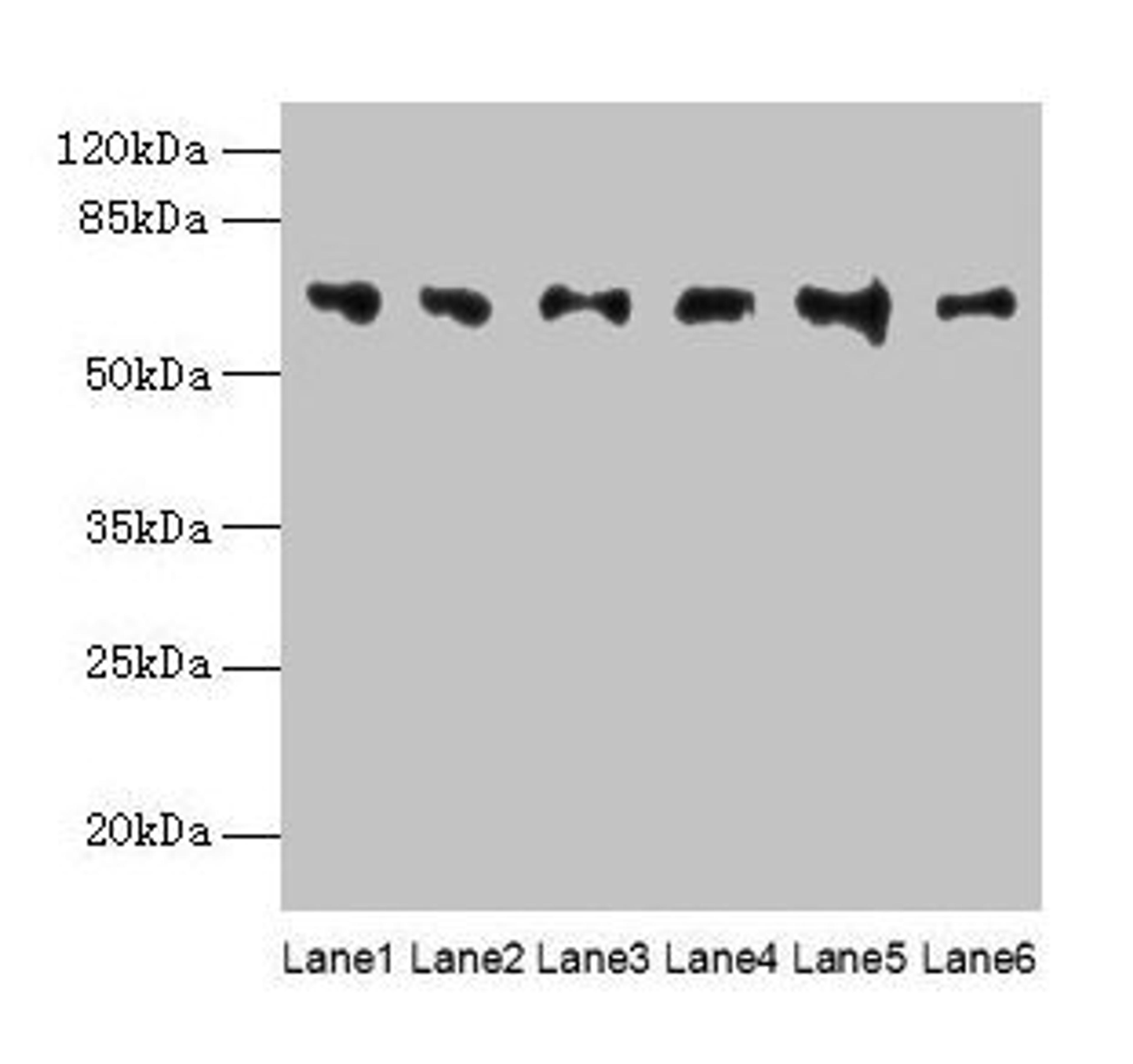 Western blot. All lanes: FBXO24 antibody at 1µg/ml. Lane 1: Mouse gonadal tissue. Lane 2: Mouse kidney tissue. Lane 3: A549 whole cell lysate. Lane 4: 293T whole cell lysate. Lane 5: Jurkat whole cell lysate. Lane 6: MCF-7 whole cell lysate. Secondary. Goat polyclonal to rabbit IgG at 1/10000 dilution. Predicted band size: 65, 37, 70, 64 kDa. Observed band size: 65 kDa