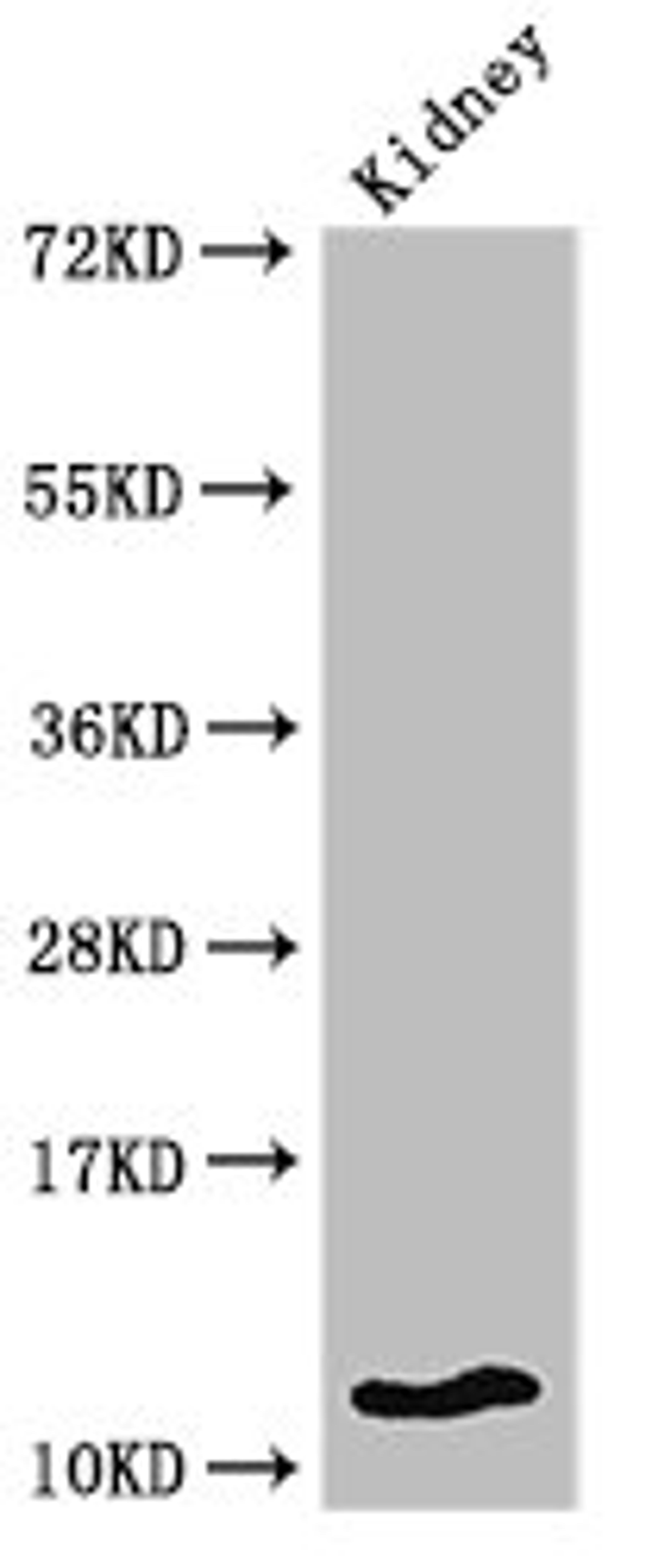 Western Blot. Positive WB detected in: Mouse kidney tissue. All lanes: HIST1H4A antibody at 2µg/ml. Secondary. Goat polyclonal to rabbit IgG at 1/50000 dilution. Predicted band size: 12 kDa. Observed band size: 12 kDa