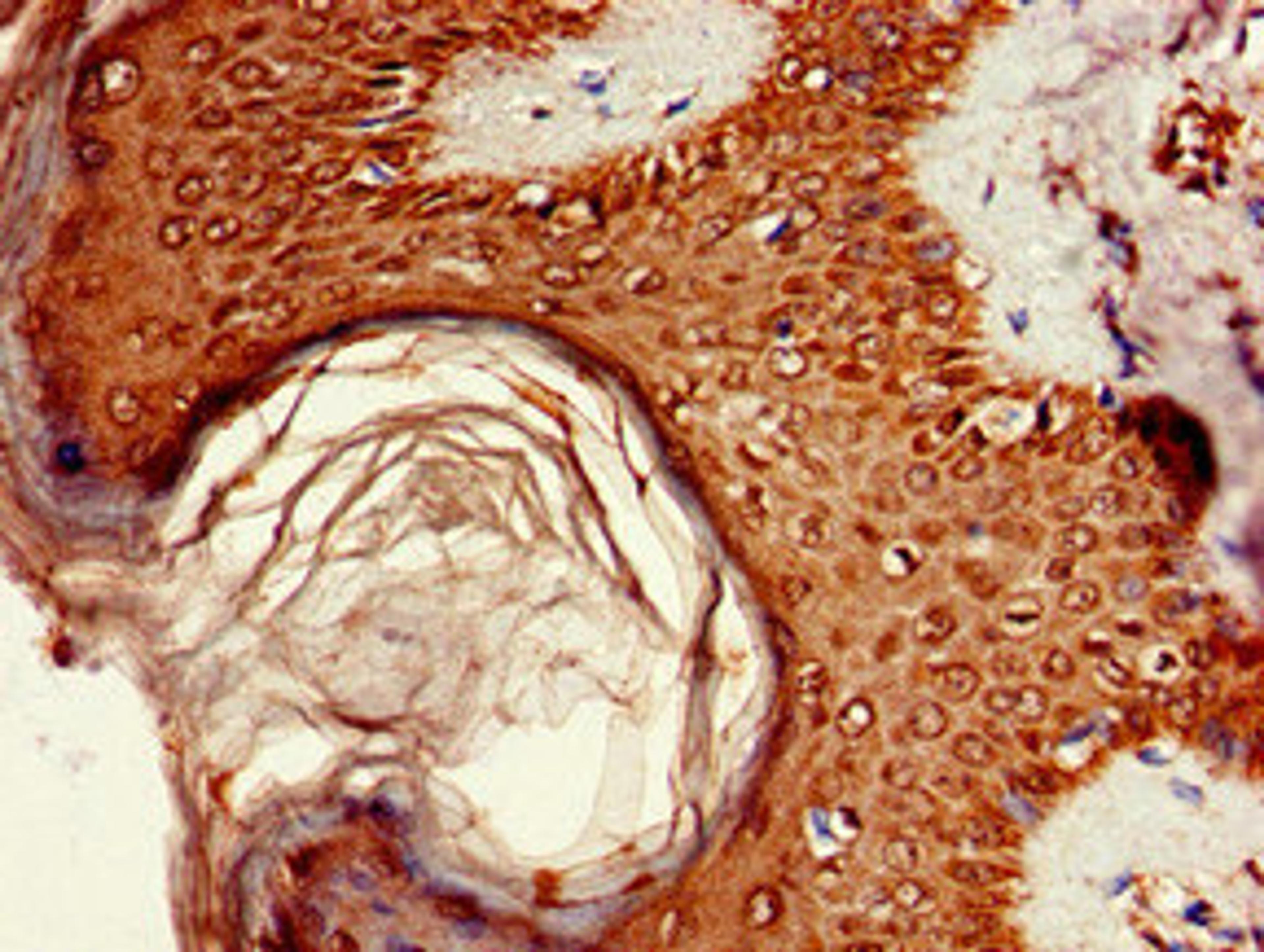 Immunohistochemistry of paraffin-embedded human skin tissue using CSB-PA836185LA01HU at dilution of 1:100