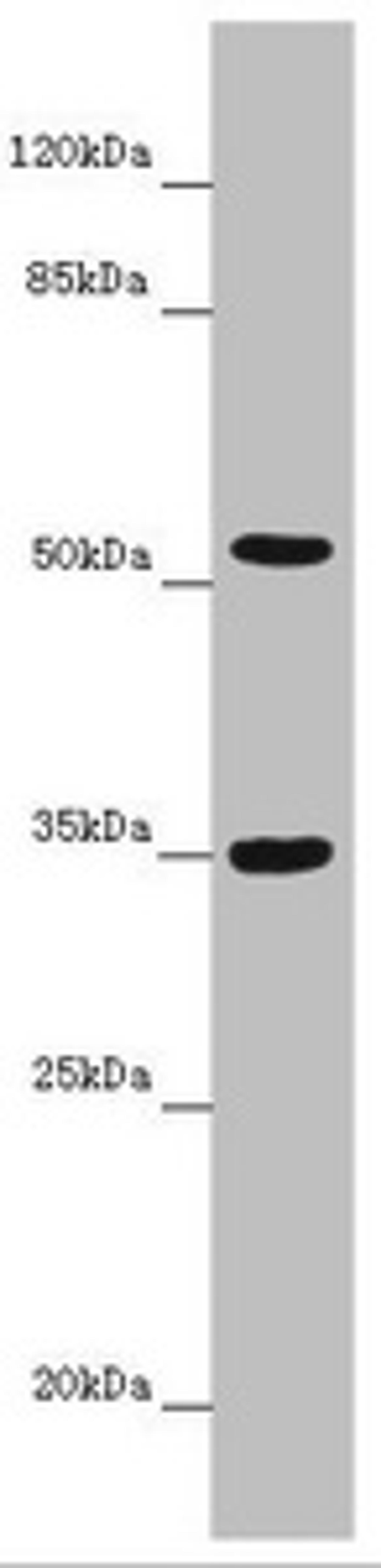 Western blot. All lanes: KCNS3 antibody at 6.35 ug/ml + Mouse lung tissue. Secondary. Goat polyclonal to rabbit IgG at 1/10000 dilution. Predicted band size: 56 kDa. Observed band size: 56, 35 kDa. 