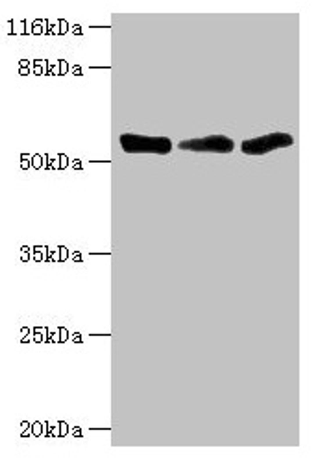 Western blot. All lanes: TFCP2 antibody at 1.34ug/ml. Lane 1: K562 whole cell lysate. Lane 2: Mouse spleen tissue. Lane 3: THP-1 whole cell lysate. Secondary. Goat polyclonal to rabbit IgG at 1/10000 dilution. Predicted band size: 58, 52 kDa. Observed band size: 52 kDa. 