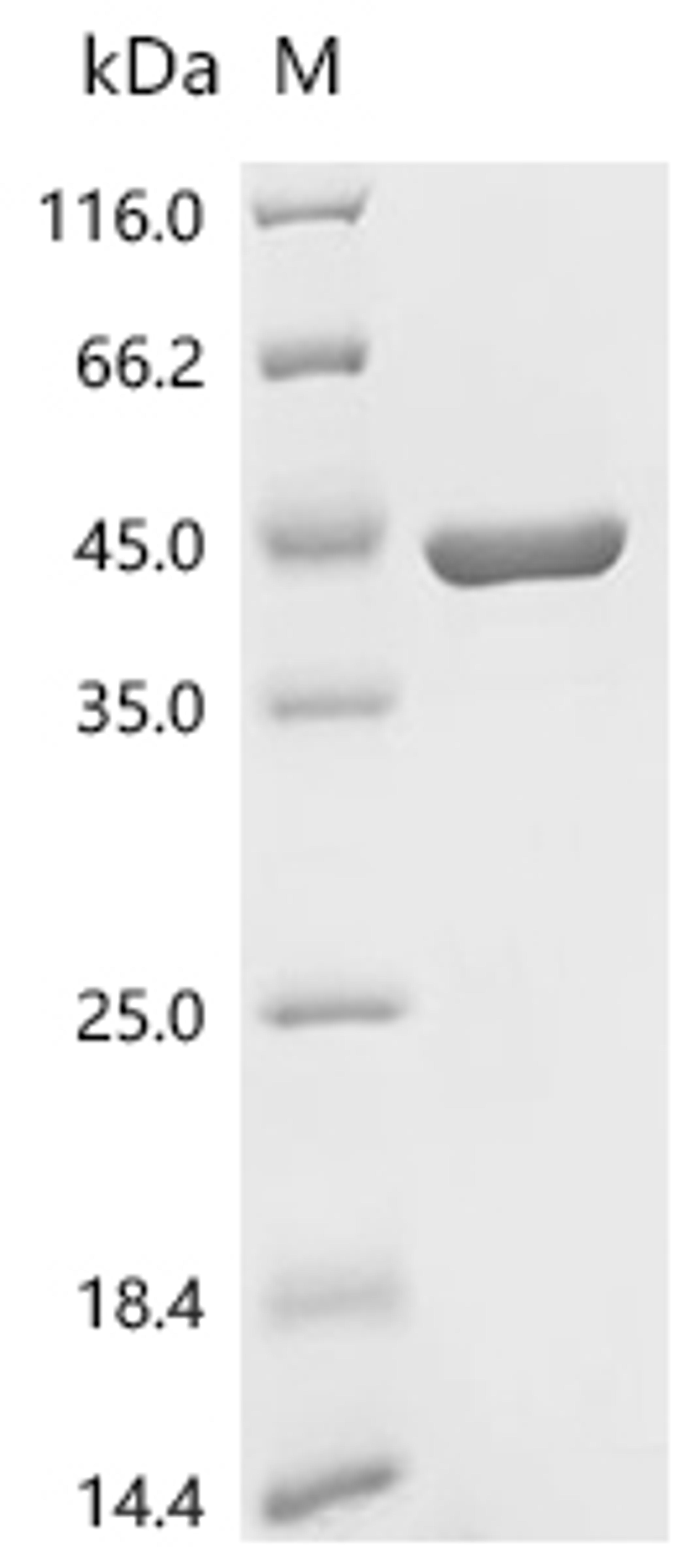 (Tris-Glycine gel) Discontinuous SDS-PAGE (reduced) with 5% enrichment gel and 15% separation gel.
