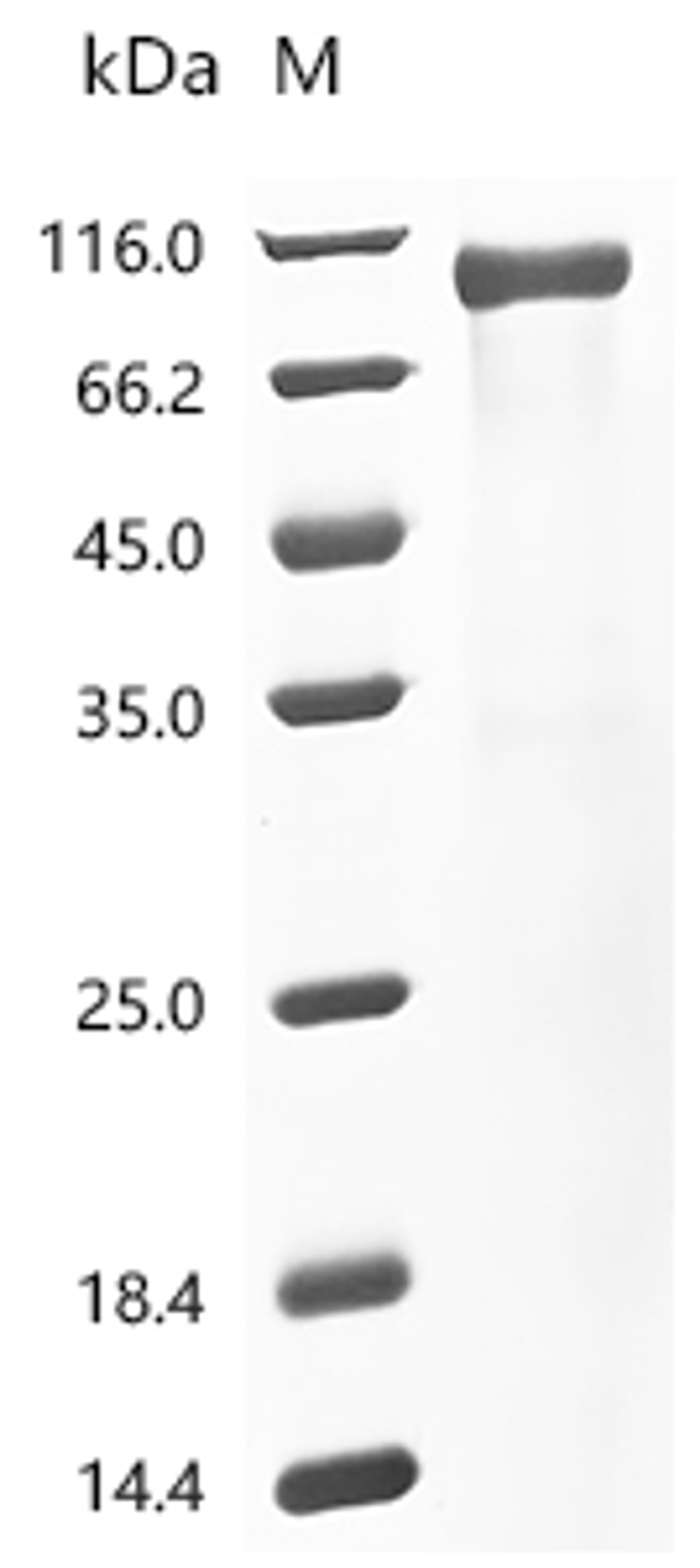 (Tris-Glycine gel) Discontinuous SDS-PAGE (reduced) with 5% enrichment gel and 15% separation gel.