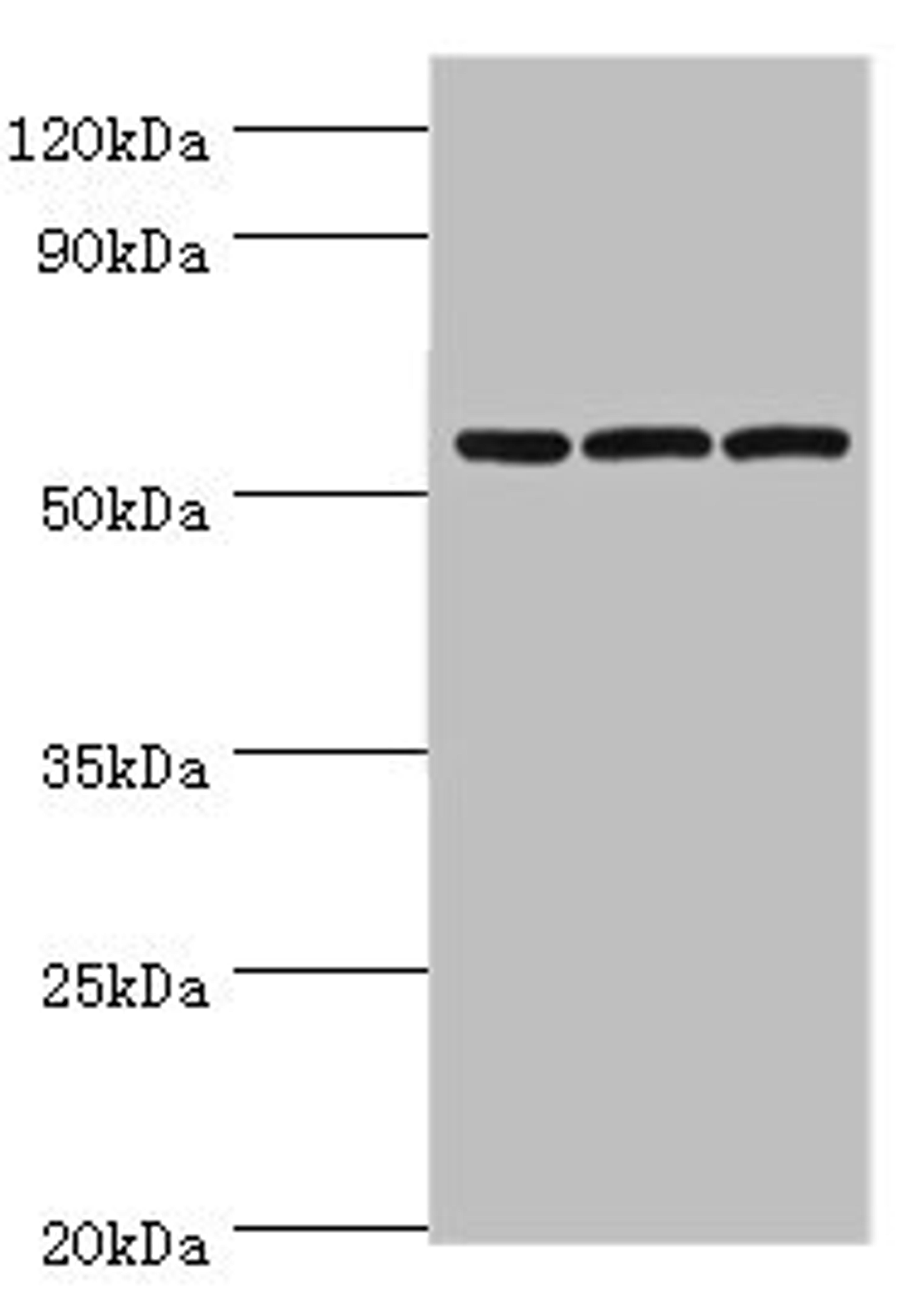 Western blot. All lanes: Alpha-amylase 2B antibody at 8ug/ml. Lane 1: Mouse skeletal muscle tissue. Lane 2: HL60 whole cell lysate. Lane 3: K562 whole cell lysate. Secondary. Goat polyclonal to rabbit IgG at 1/10000 dilution. Predicted band size: 58, 43 kDa. Observed band size: 58 kDa.