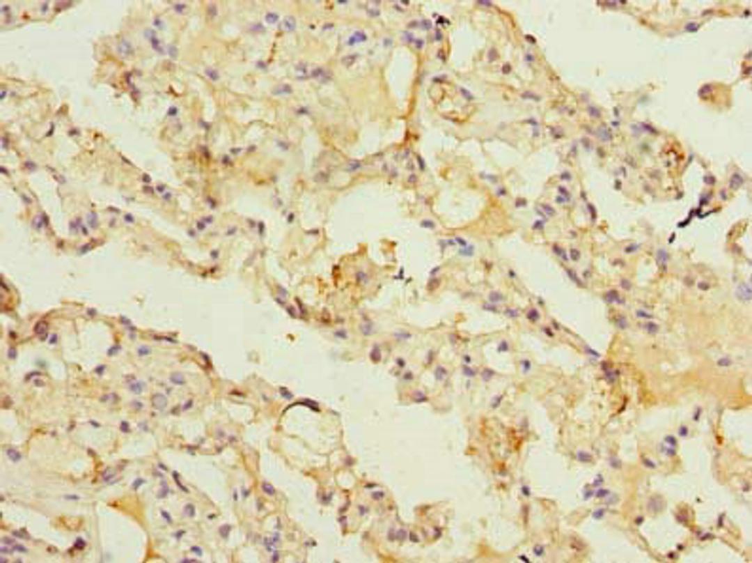 Immunohistochemistry of paraffin-embedded human lung tissue using CSB-PA850249LA01HU at dilution of 1:100