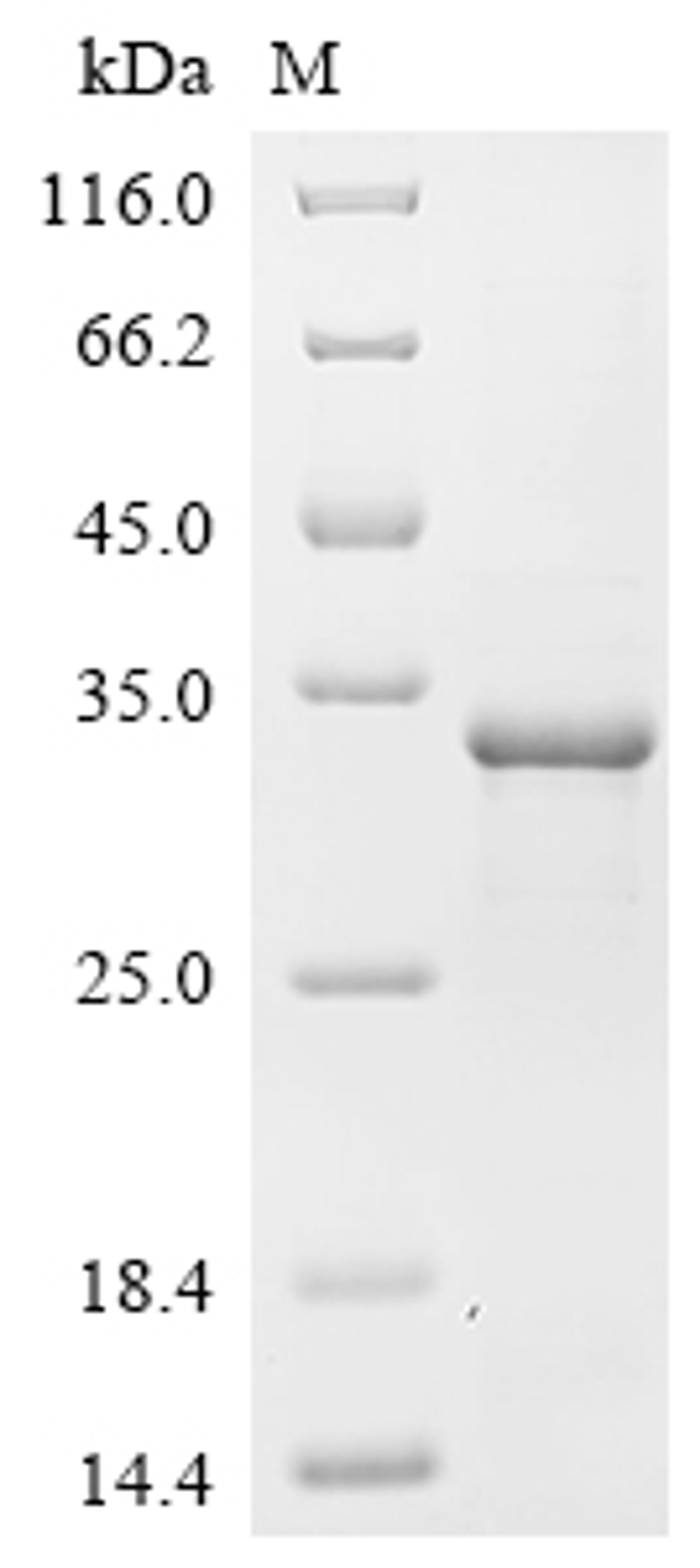 (Tris-Glycine gel) Discontinuous SDS-PAGE (reduced) with 5% enrichment gel and 15% separation gel.