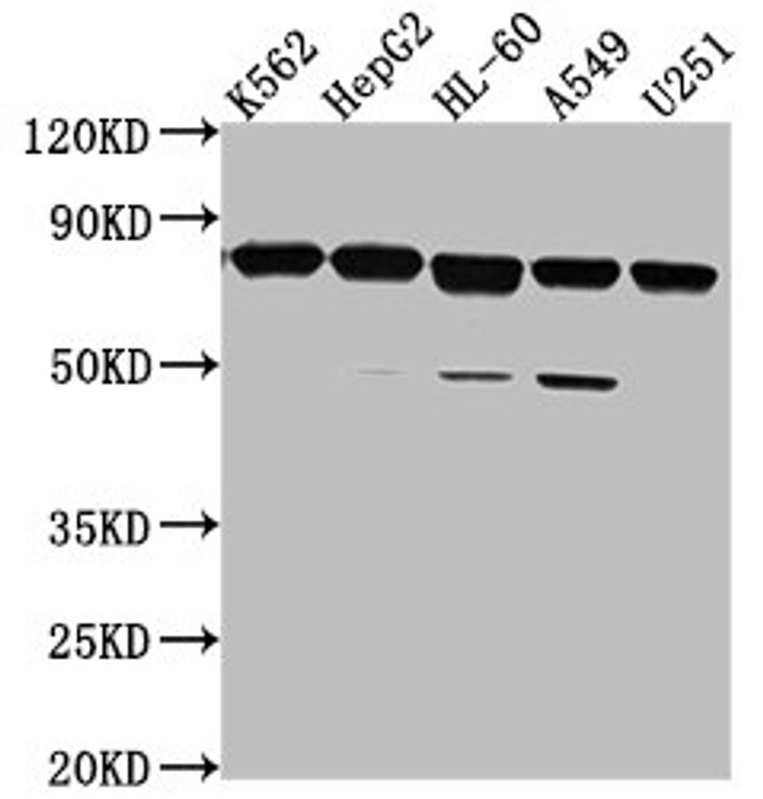 Western Blot. Positive WB detected in: K562 whole cell lysate, HepG2 whole cell lysate, HL-60 whole cell lysate, A549 whole cell lysate, U251 whole cell lysate. All lanes: TMEM214 antibody at 1:2000. Secondary. Goat polyclonal to rabbit IgG at 1/50000 dilution. Predicted band size: 78, 73 kDa. Observed band size: 78 kDa. 