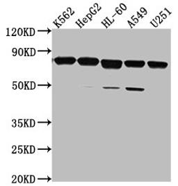 Western Blot. Positive WB detected in: K562 whole cell lysate, HepG2 whole cell lysate, HL-60 whole cell lysate, A549 whole cell lysate, U251 whole cell lysate. All lanes: TMEM214 antibody at 1:2000. Secondary. Goat polyclonal to rabbit IgG at 1/50000 dilution. Predicted band size: 78, 73 kDa. Observed band size: 78 kDa. 