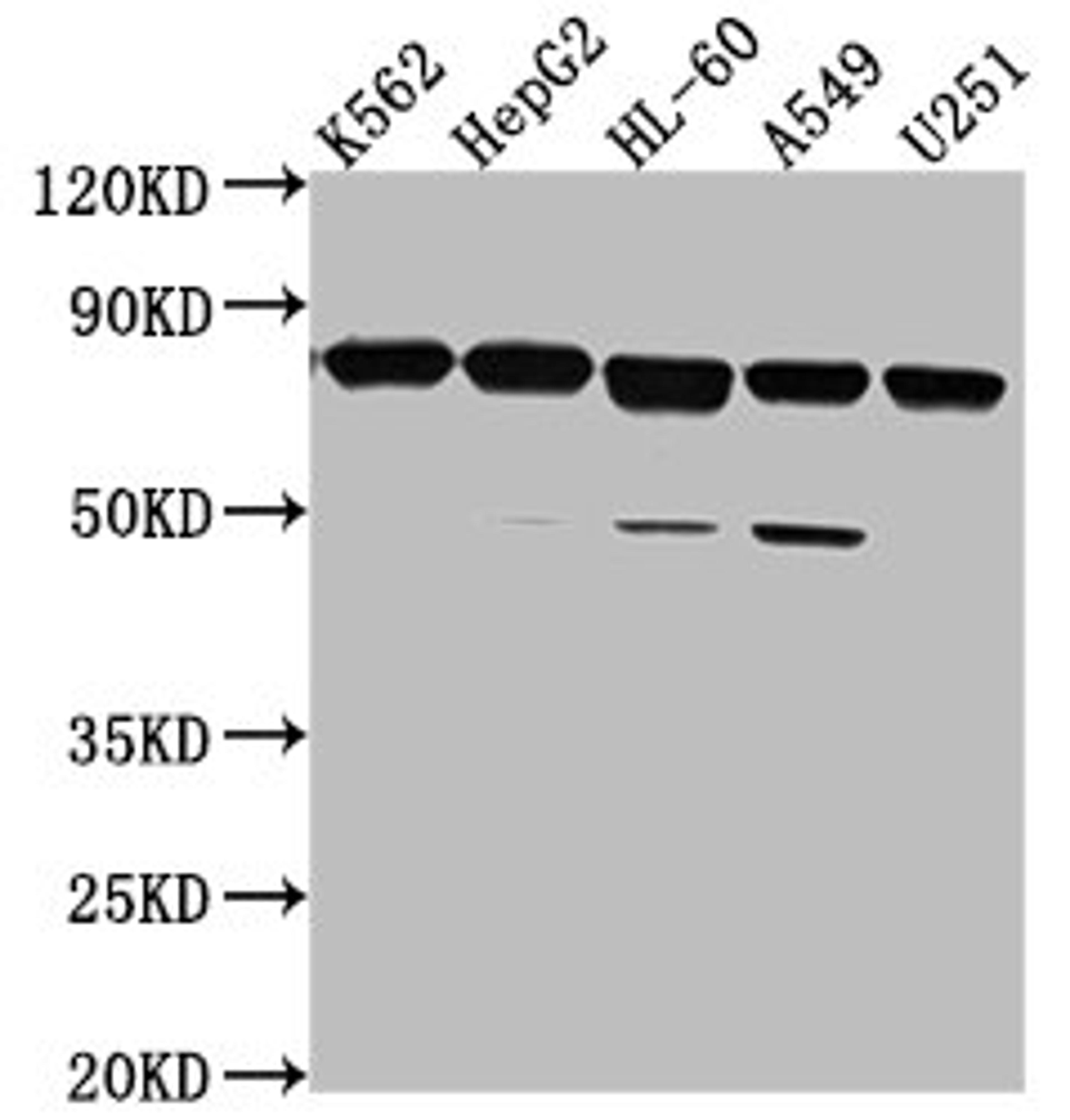Western Blot. Positive WB detected in: K562 whole cell lysate, HepG2 whole cell lysate, HL-60 whole cell lysate, A549 whole cell lysate, U251 whole cell lysate. All lanes: TMEM214 antibody at 1:2000. Secondary. Goat polyclonal to rabbit IgG at 1/50000 dilution. Predicted band size: 78, 73 kDa. Observed band size: 78 kDa. 