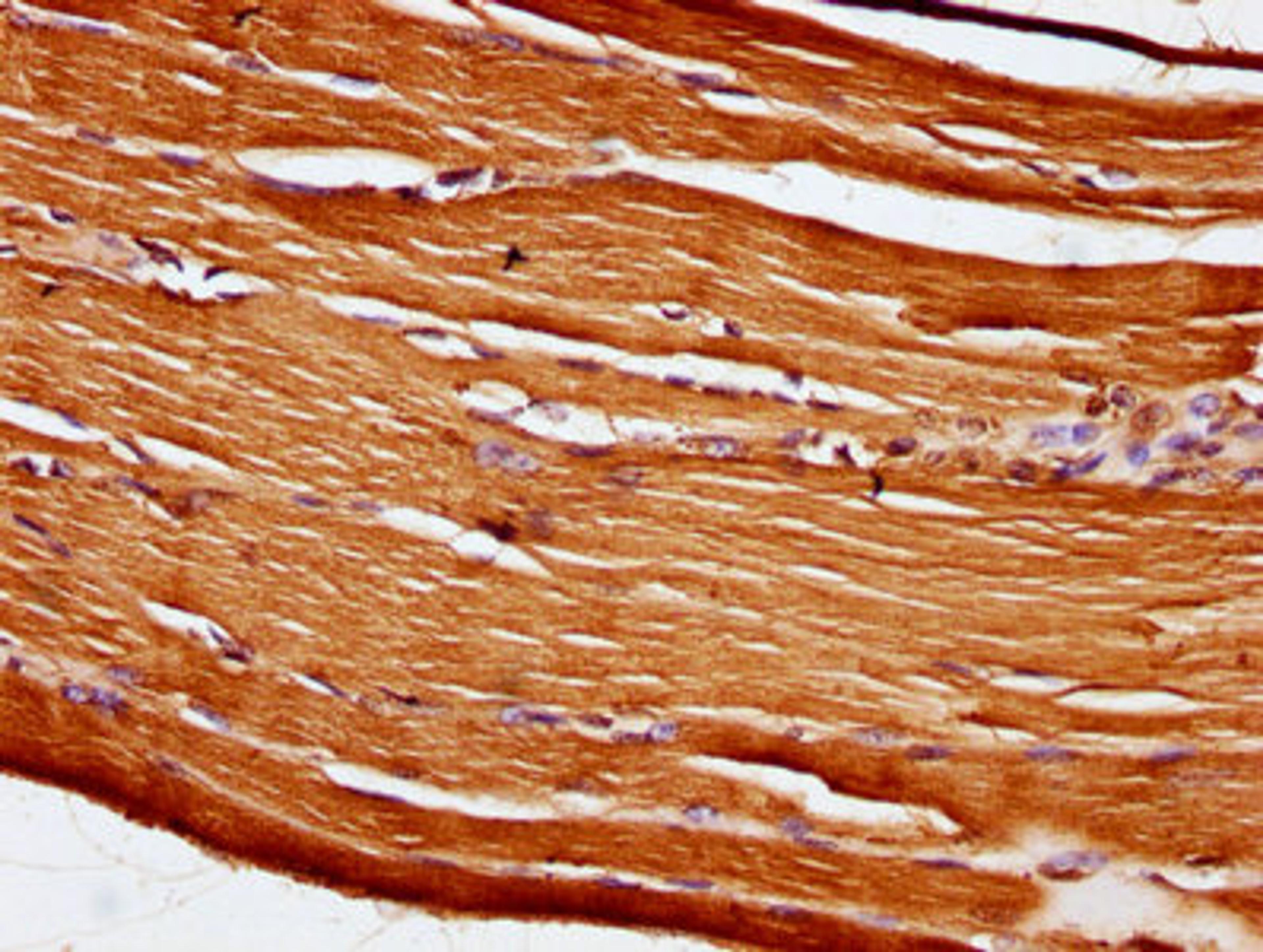 IHC image of CSB-PA729422LA01HU diluted at 1:100 and staining in paraffin-embedded human skeletal muscle tissue performed on a Leica BondTM system. After dewaxing and hydration, antigen retrieval was mediated by high pressure in a citrate buffer (pH 6.0). Section was blocked with 10% normal goat serum 30min at RT. Then primary antibody (1% BSA) was incubated at 4&deg;C overnight. The primary is detected by a biotinylated secondary antibody and visualized using an HRP conjugated SP system.