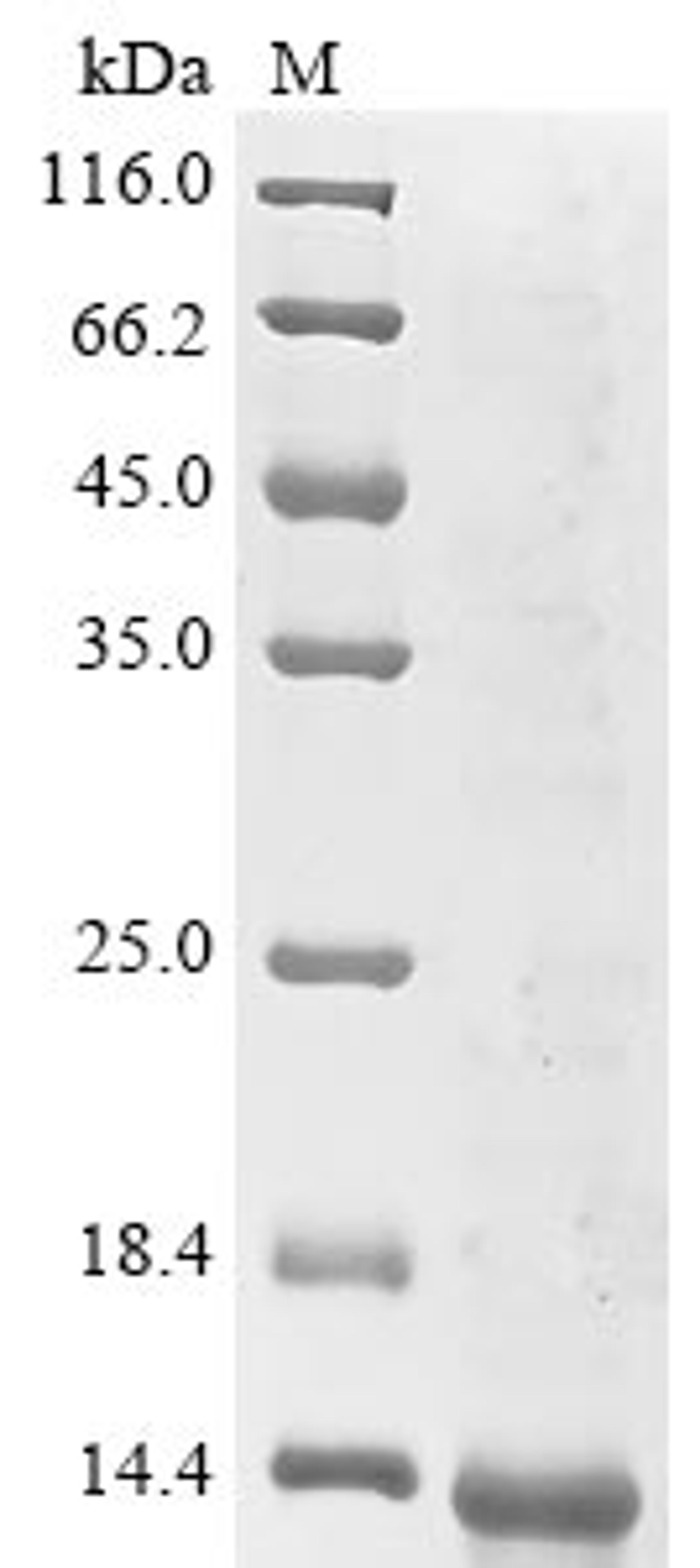 (Tris-Glycine gel) Discontinuous SDS-PAGE (reduced) with 5% enrichment gel and 15% separation gel.