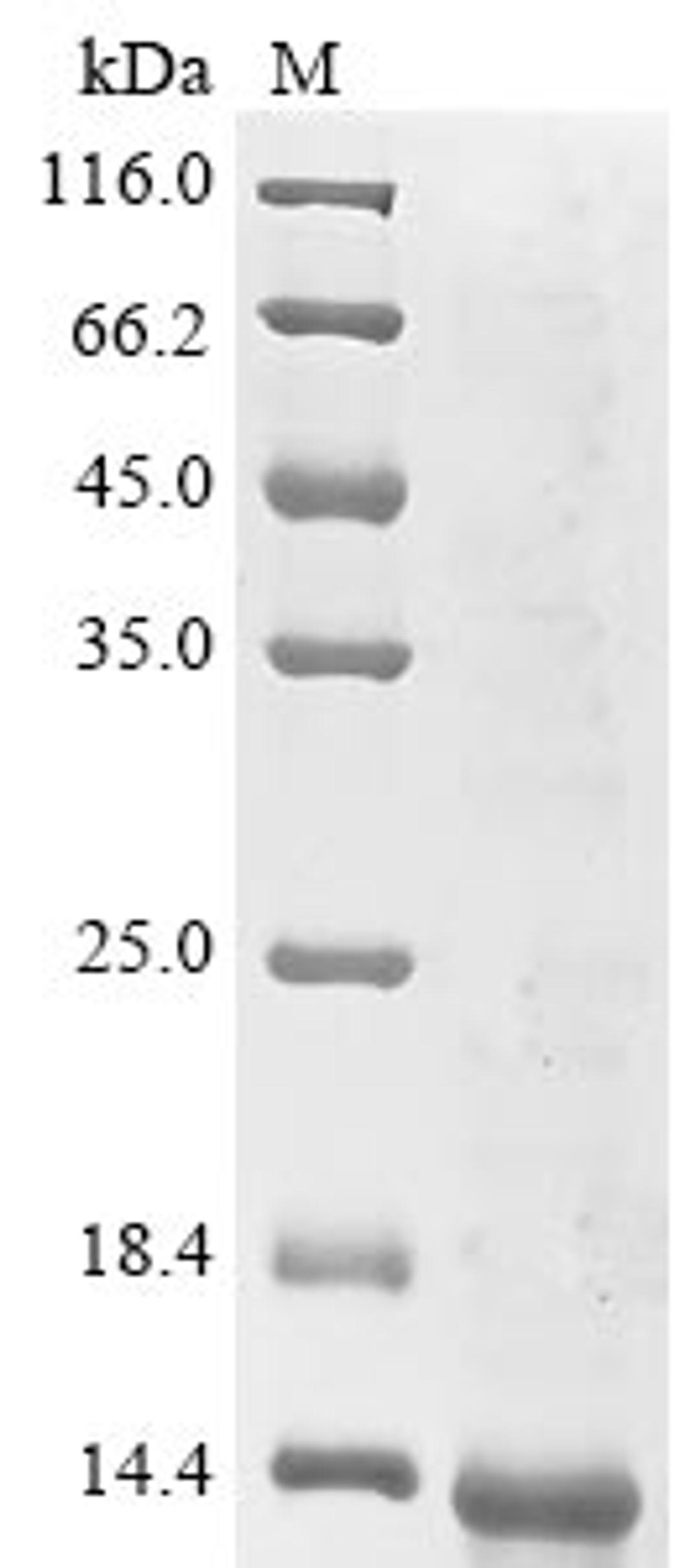 (Tris-Glycine gel) Discontinuous SDS-PAGE (reduced) with 5% enrichment gel and 15% separation gel.