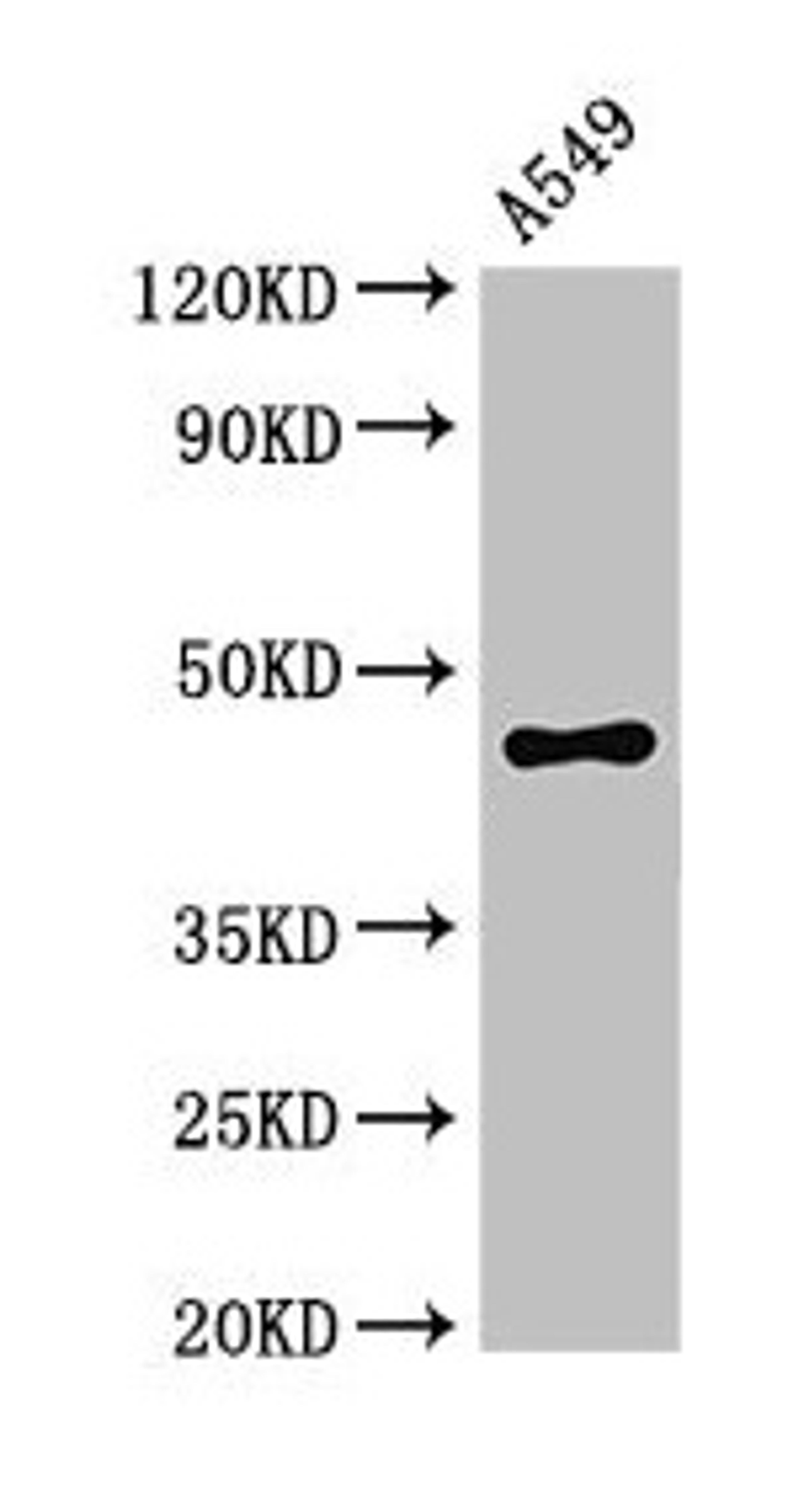 Western Blot. Positive WB detected in: A549 whole cell lysate. All lanes: PHAX antibody at 2.8µg/ml. Secondary. Goat polyclonal to rabbit IgG at 1/50000 dilution. Predicted band size: 45 kDa. Observed band size: 45 kDa