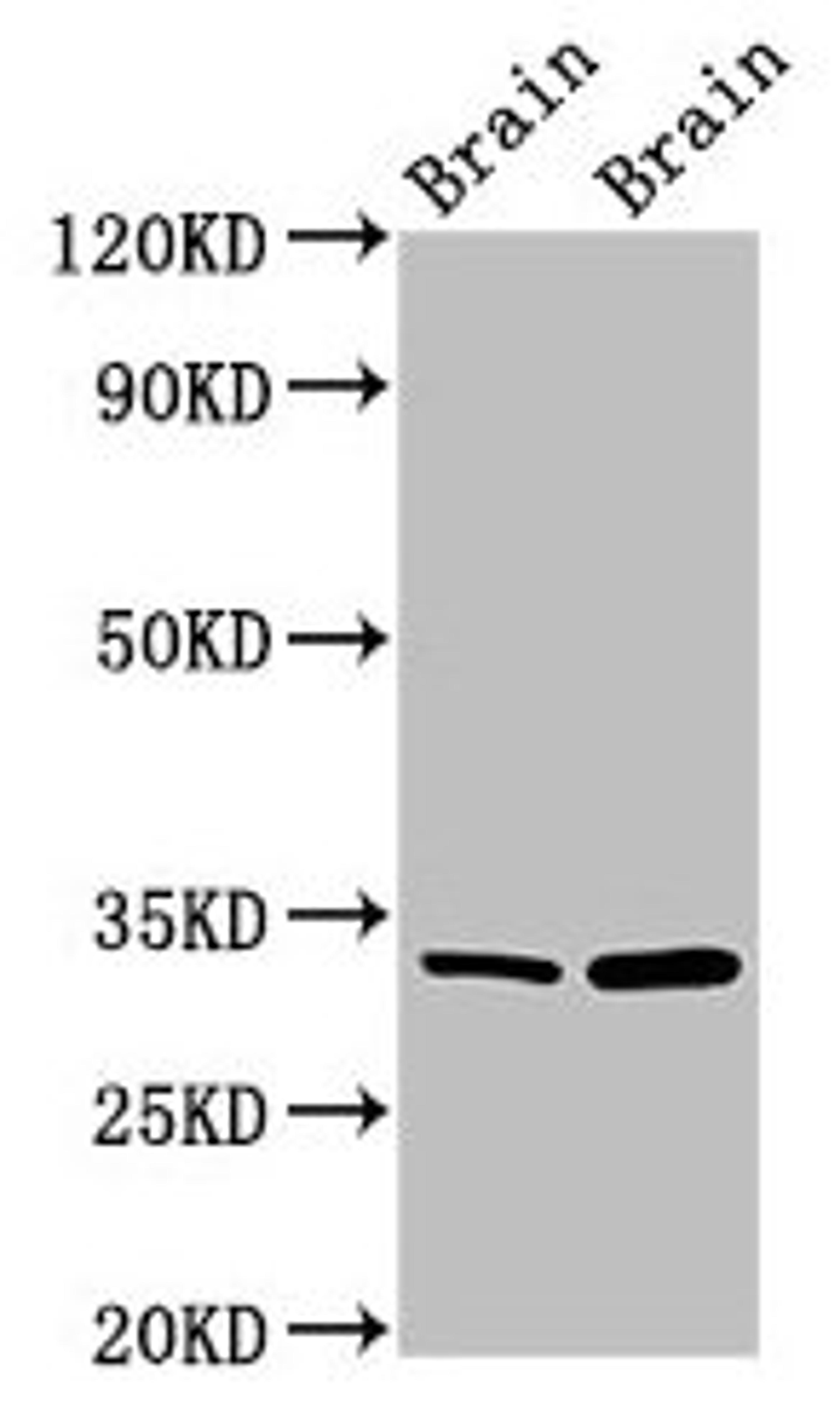 Western Blot. Positive WB detected in: Mouse brain tissue, Rat brain tissue. All lanes: HAX1 antibody at 1.5µg/ml. Secondary. Goat polyclonal to rabbit IgG at 1/50000 dilution. Predicted band size: 32, 33, 29, 15, 27, 22 kDa. Observed band size: 32 kDa