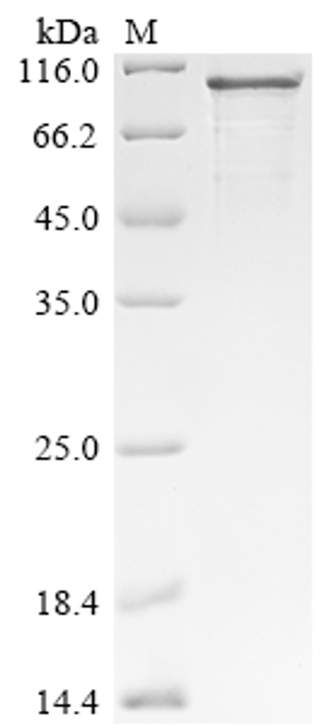 (Tris-Glycine gel) Discontinuous SDS-PAGE (reduced) with 5% enrichment gel and 15% separation gel.
