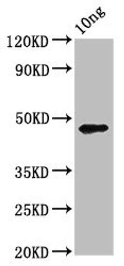 Western Blot. Positive WB detected in Recombinant protein. All lanes: pmpD antibody at 3.9ug/ml. Secondary. Goat polyclonal to rabbit IgG at 1/50000 dilution. Predicted band size: 47 kDa. Observed band size: 47 kDa. 