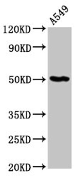 Western Blot. Positive WB detected in: A549 whole cell lysate. All lanes: GDI1 antibody at 6µg/ml. Secondary. Goat polyclonal to rabbit IgG at 1/50000 dilution. Predicted band size: 51 kDa. Observed band size: 51 kDa