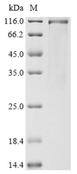 (Tris-Glycine gel) Discontinuous SDS-PAGE (reduced) with 5% enrichment gel and 15% separation gel.