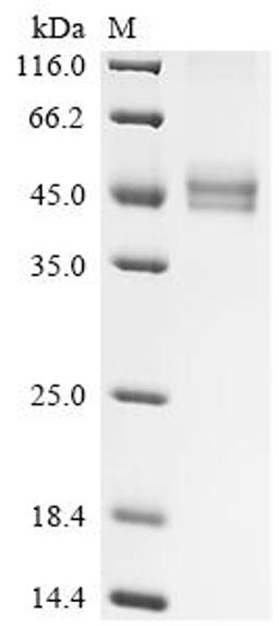 (Tris-Glycine gel) Discontinuous SDS-PAGE (reduced) with 5% enrichment gel and 15% separation gel.