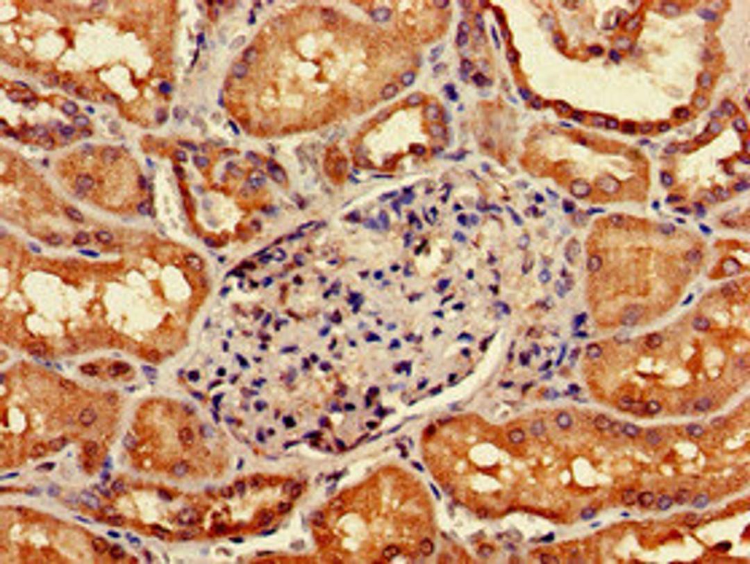 Immunohistochemistry of paraffin-embedded human kidney tissue using CSB-PA009435LA01HU at dilution of 1:100