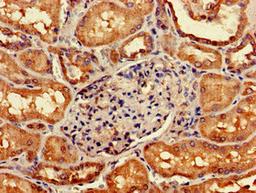 Immunohistochemistry of paraffin-embedded human kidney tissue using CSB-PA009435LA01HU at dilution of 1:100