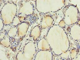 Immunohistochemistry of paraffin-embedded human thyroid tissue using CSB-PA019881LA01HU at dilution of 1:100